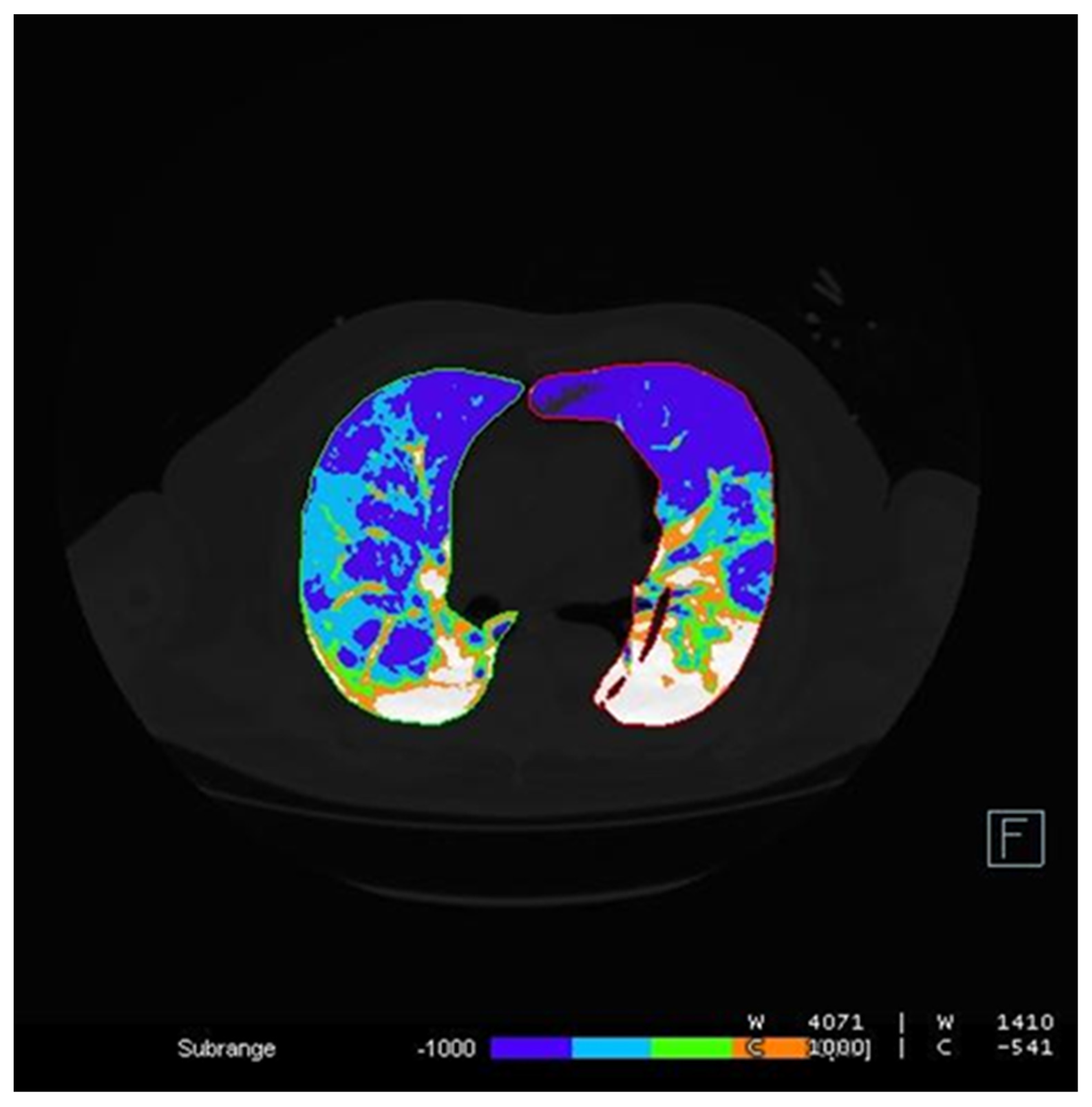 Diagnostics 12 01501 g008