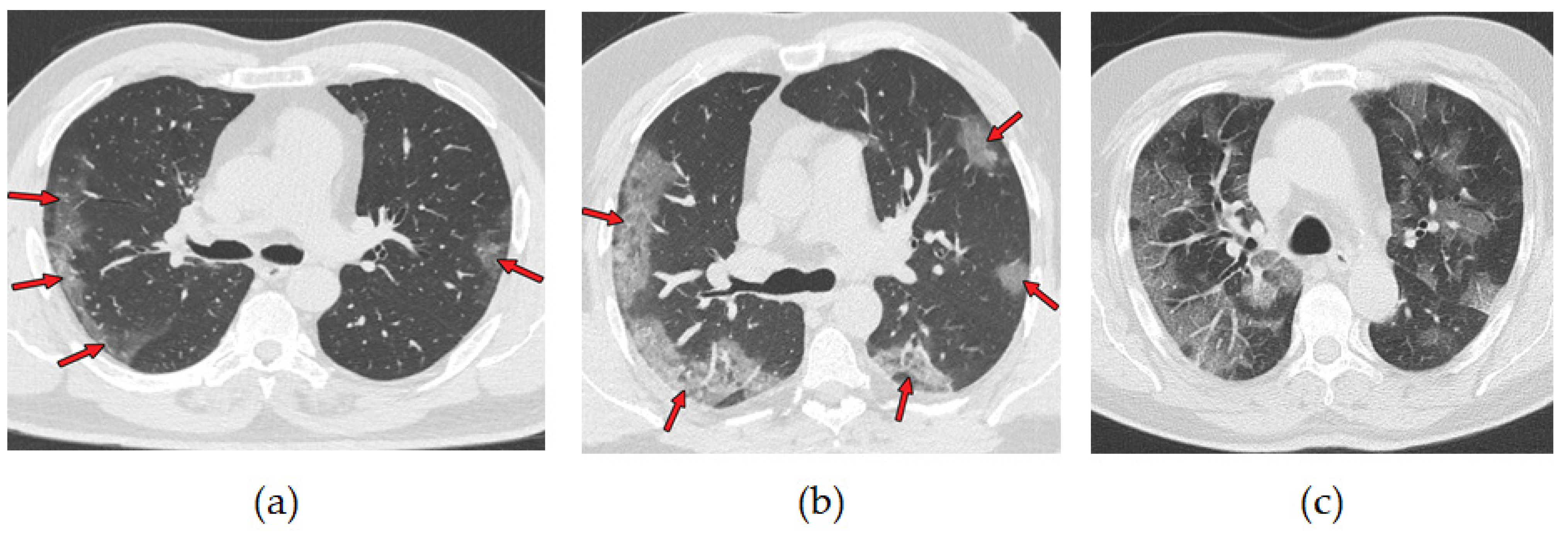 Diagnostics | Free Full-Text | A Light Deep Learning Algorithm for CT ...