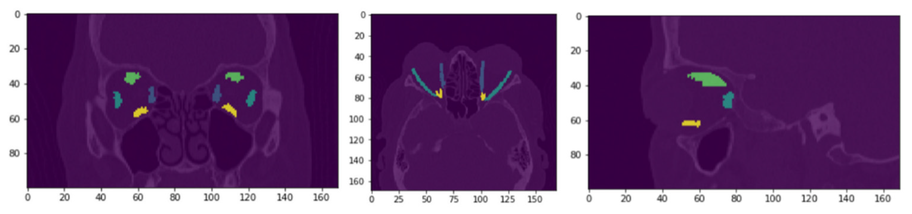 Diagnostics 12 01553 g003