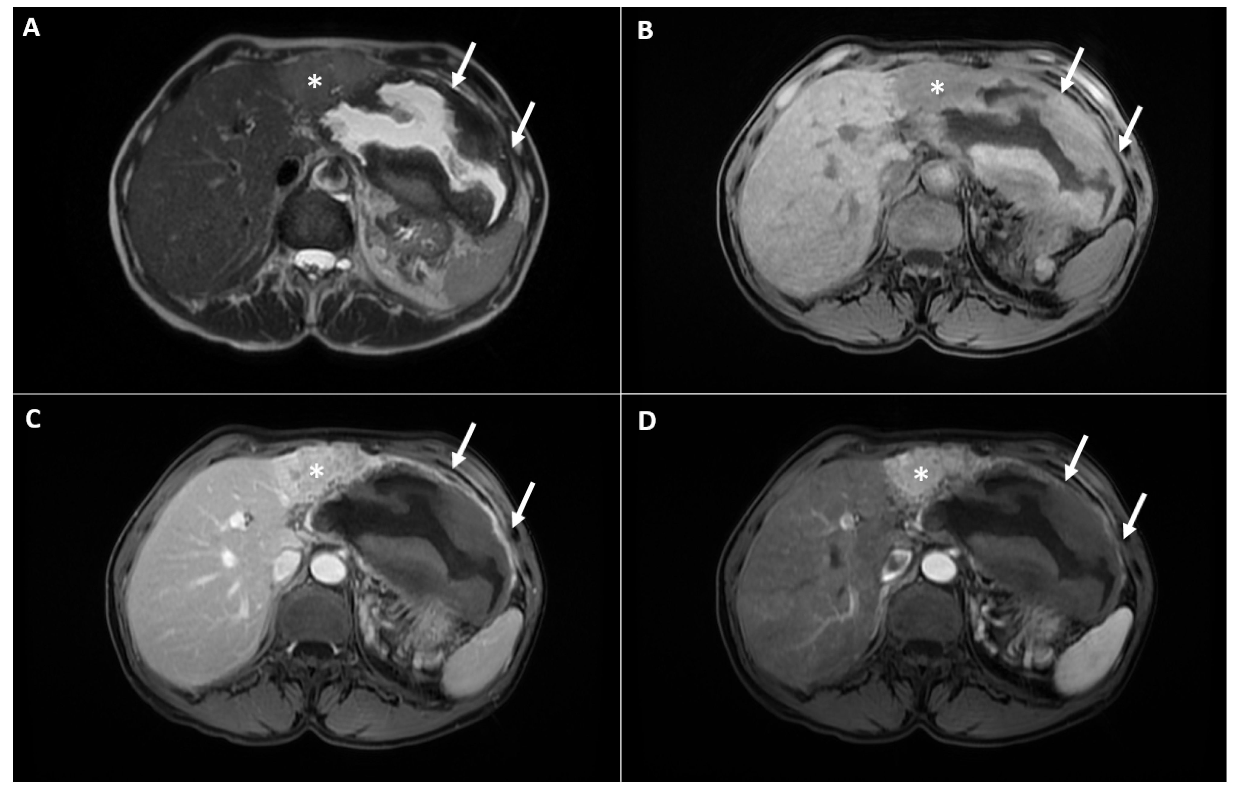 Diagnostics 12 01583 g002 Diagnostics 12 01583 g002