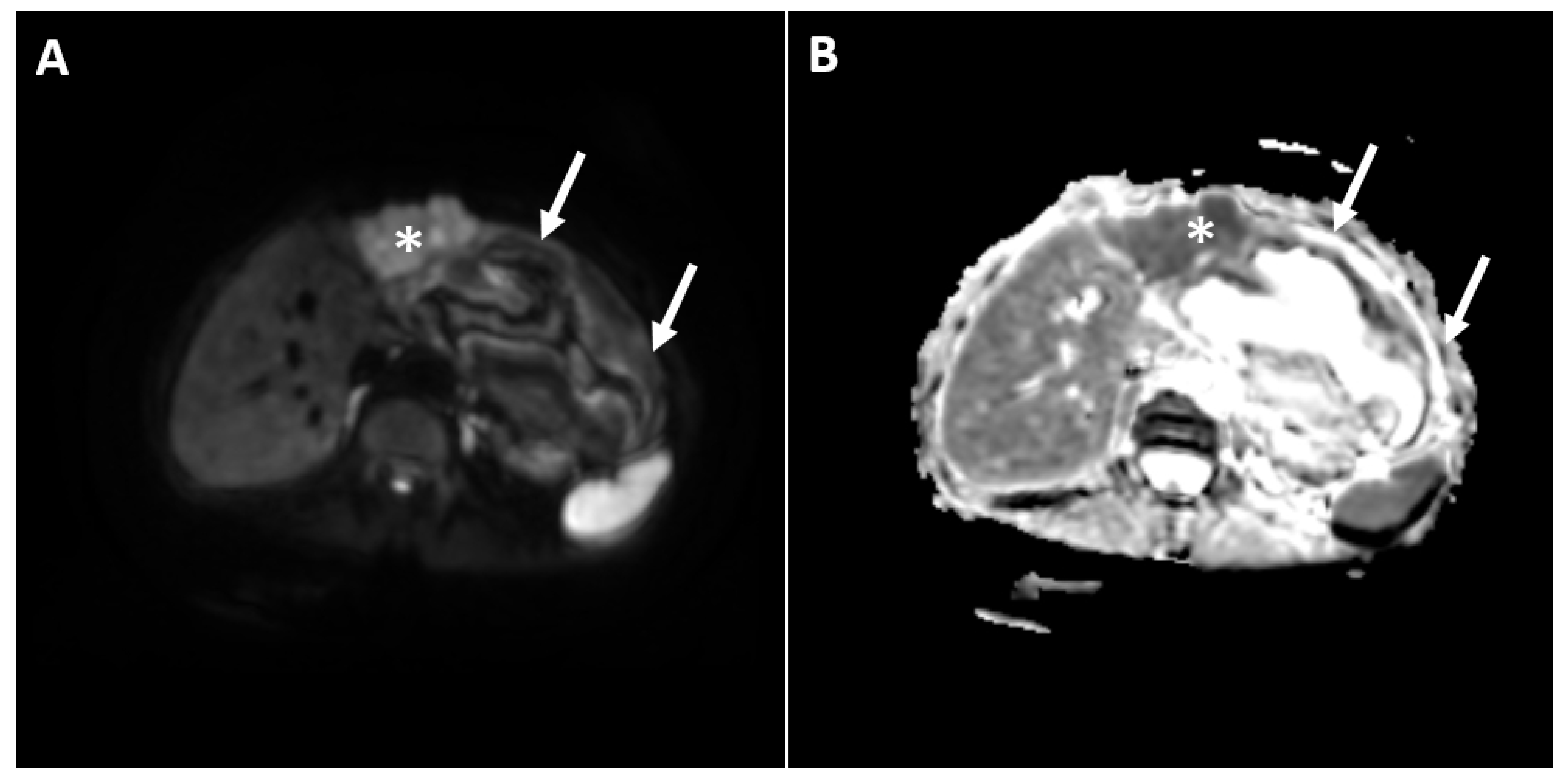 Diagnostics 12 01583 g003 Diagnostics 12 01583 g003