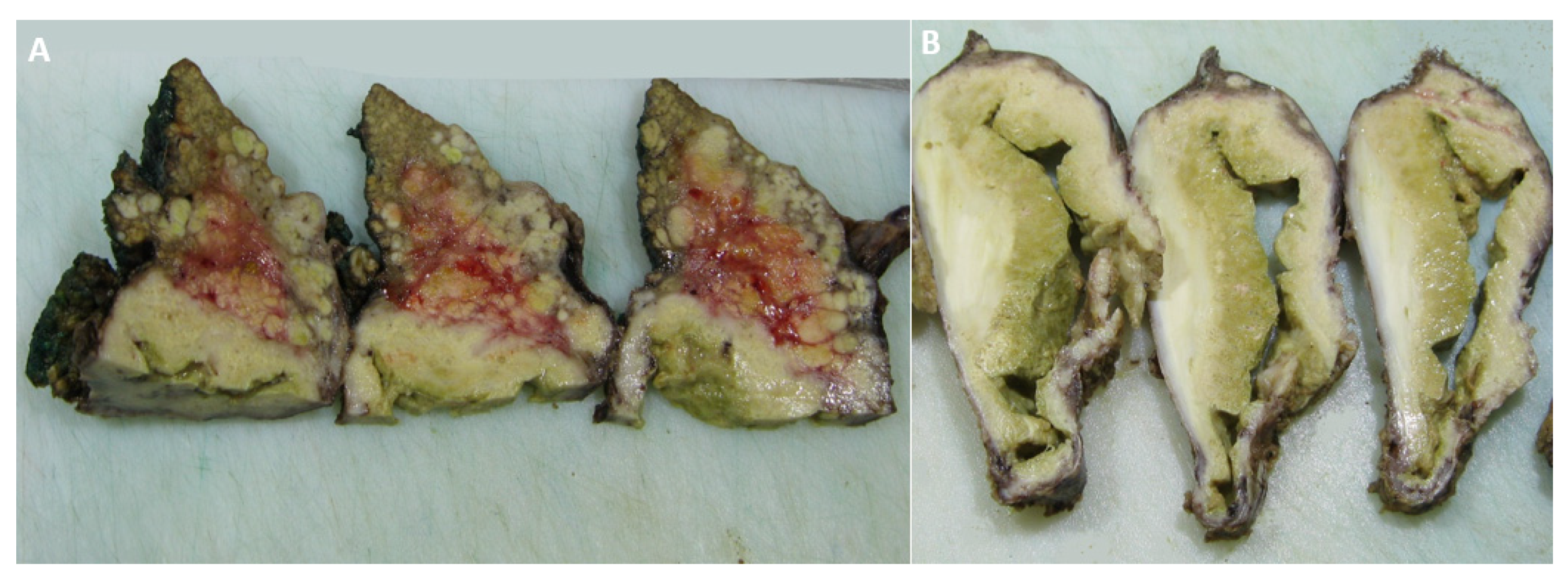 Diagnostics 12 01583 g004 Diagnostics 12 01583 g004
