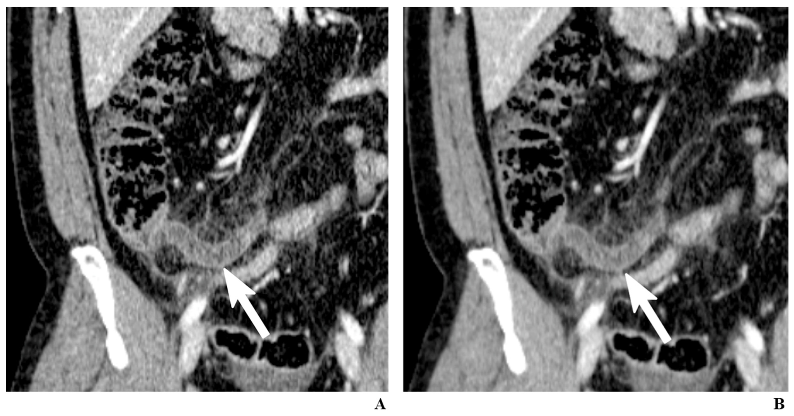 Diagnostics 12 01585 g001 Diagnostics 12 01585 g001