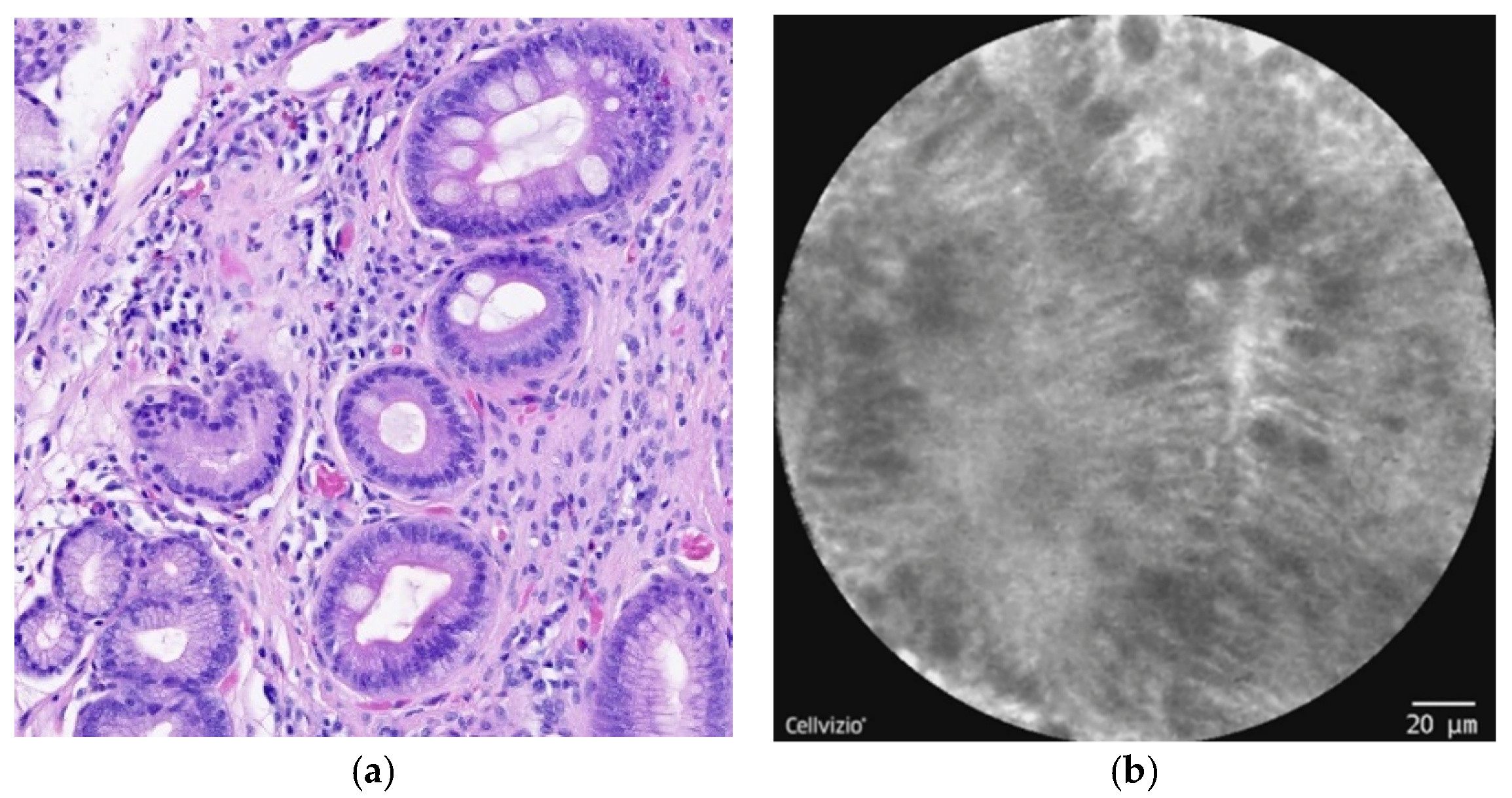 Diagnostics 12 01616 g002 Diagnostics 12 01616 g002