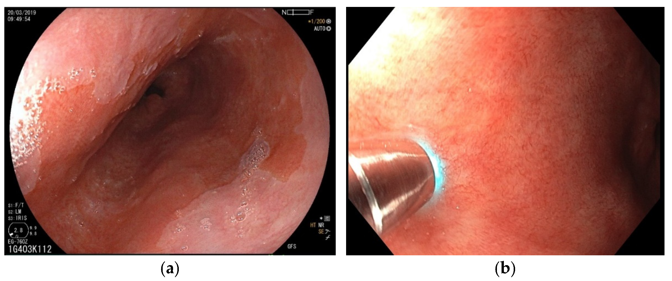 Diagnostics 12 01616 g003 Diagnostics 12 01616 g003