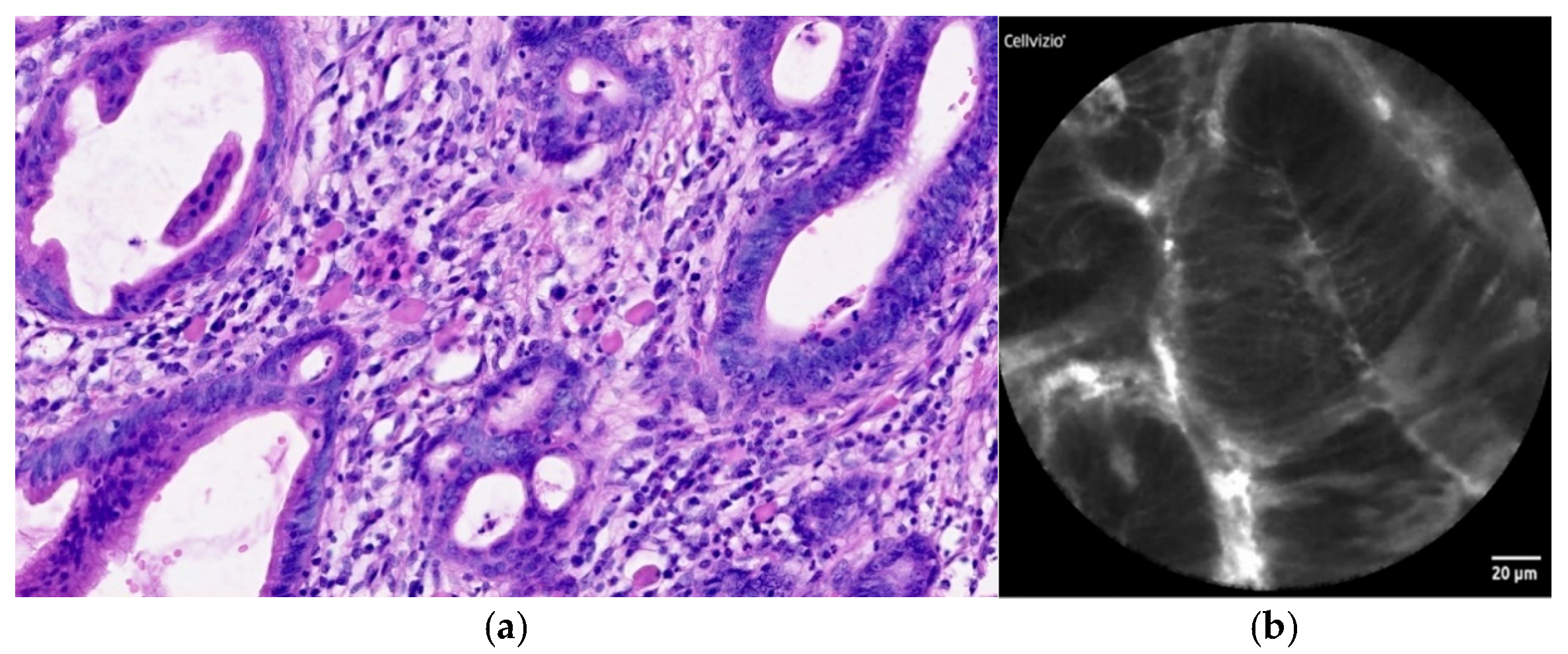 Diagnostics 12 01616 g004 Diagnostics 12 01616 g004