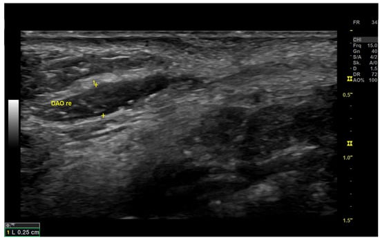 Diagnostics | Free Full-Text | Using High-Resolution Ultrasound to ...