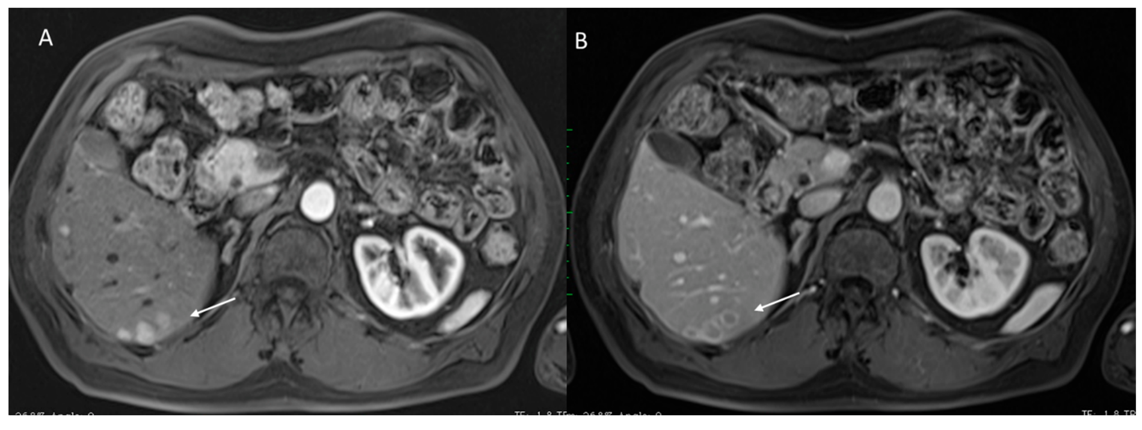 Diagnostics 12 01655 g005