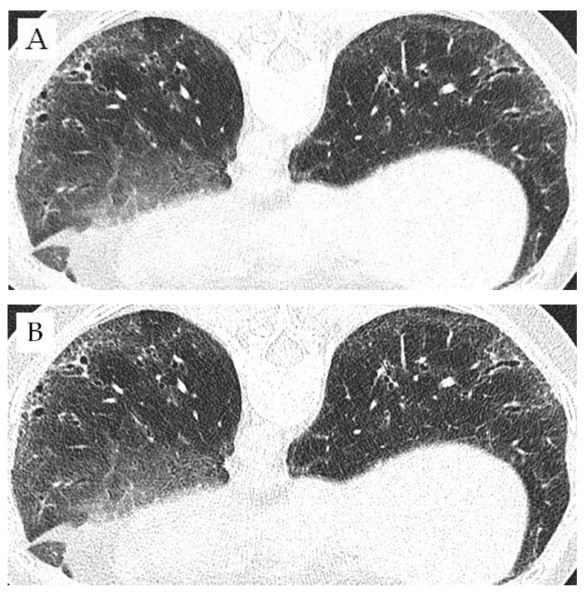 Diagnostics 12 01662 g004