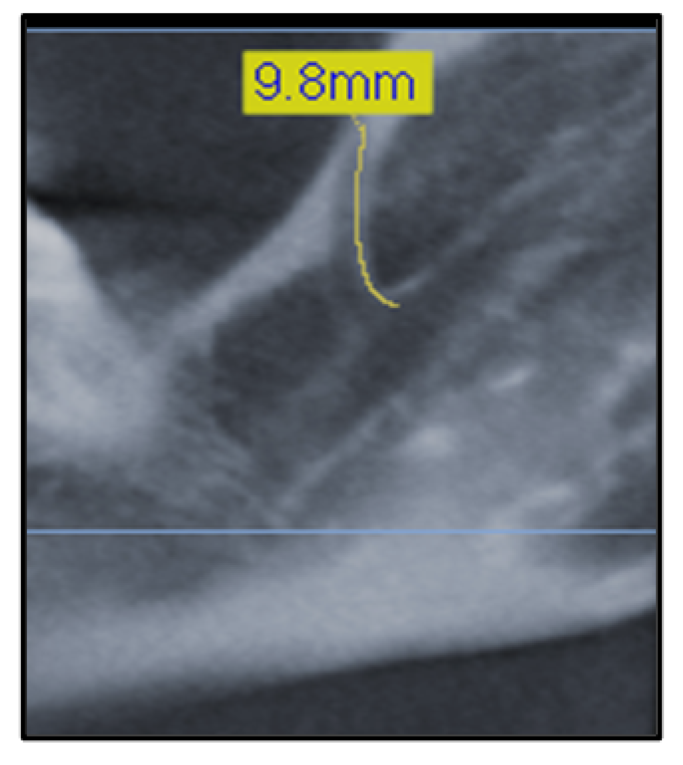 Diagnostics 12 01885 g003 Diagnostics 12 01885 g003