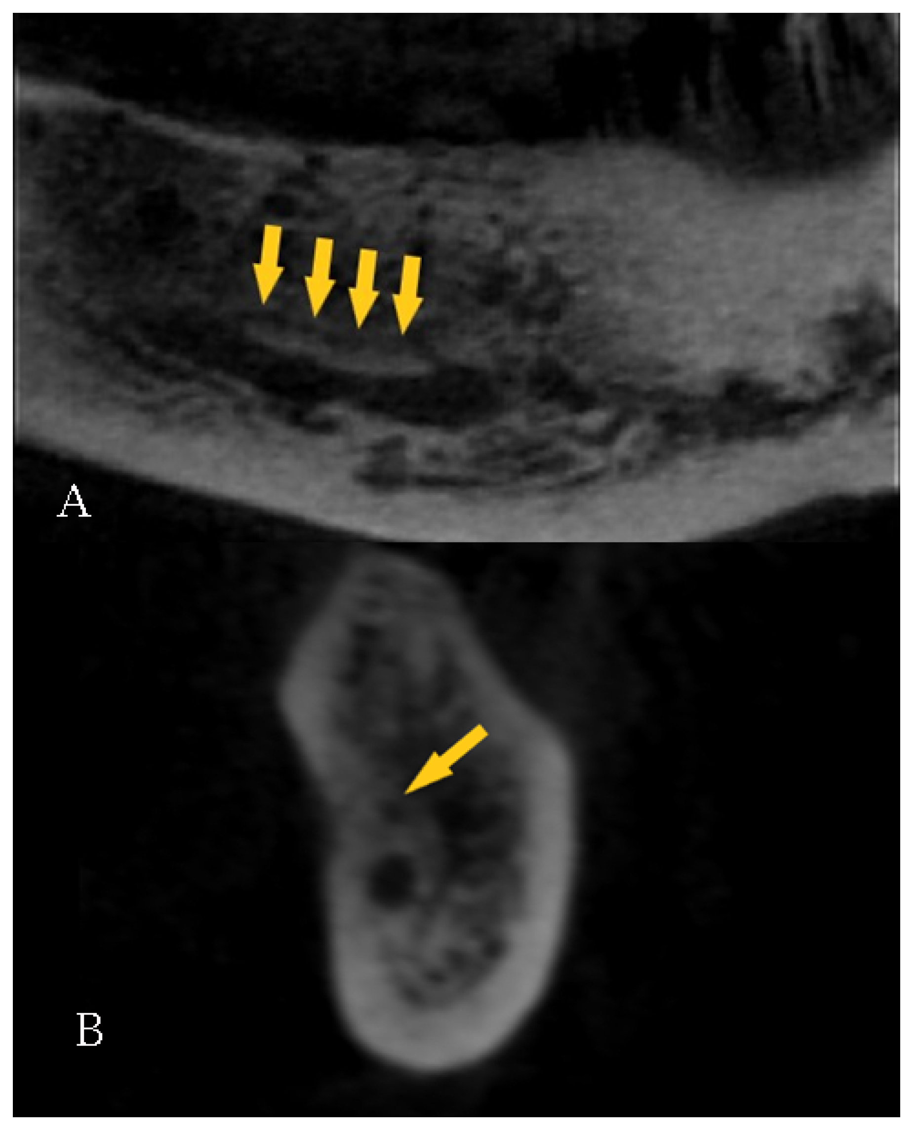 Diagnostics 12 01885 g007 Diagnostics 12 01885 g007
