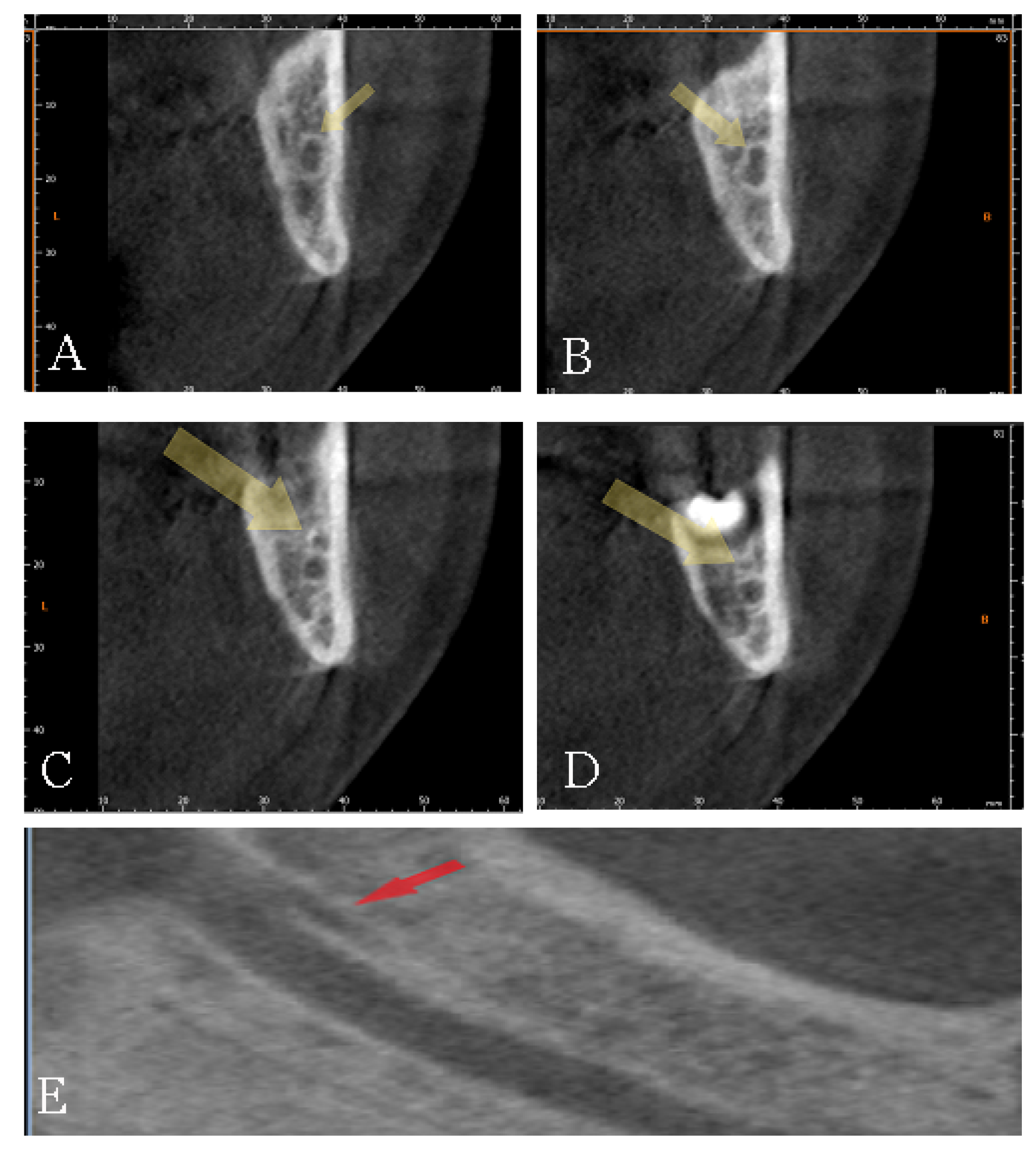 Diagnostics 12 01885 g008 Diagnostics 12 01885 g008