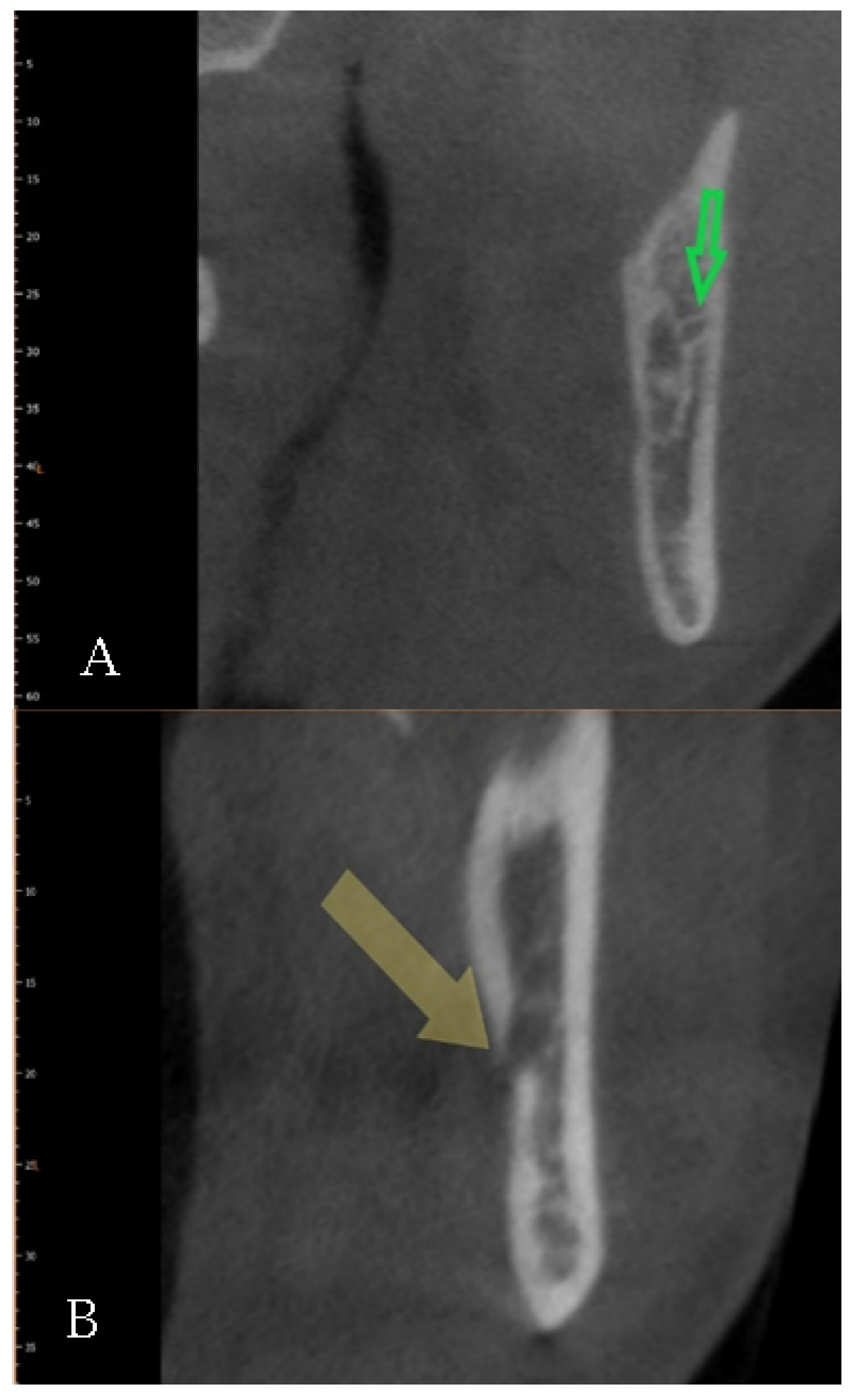 Diagnostics 12 01885 g009 Diagnostics 12 01885 g009