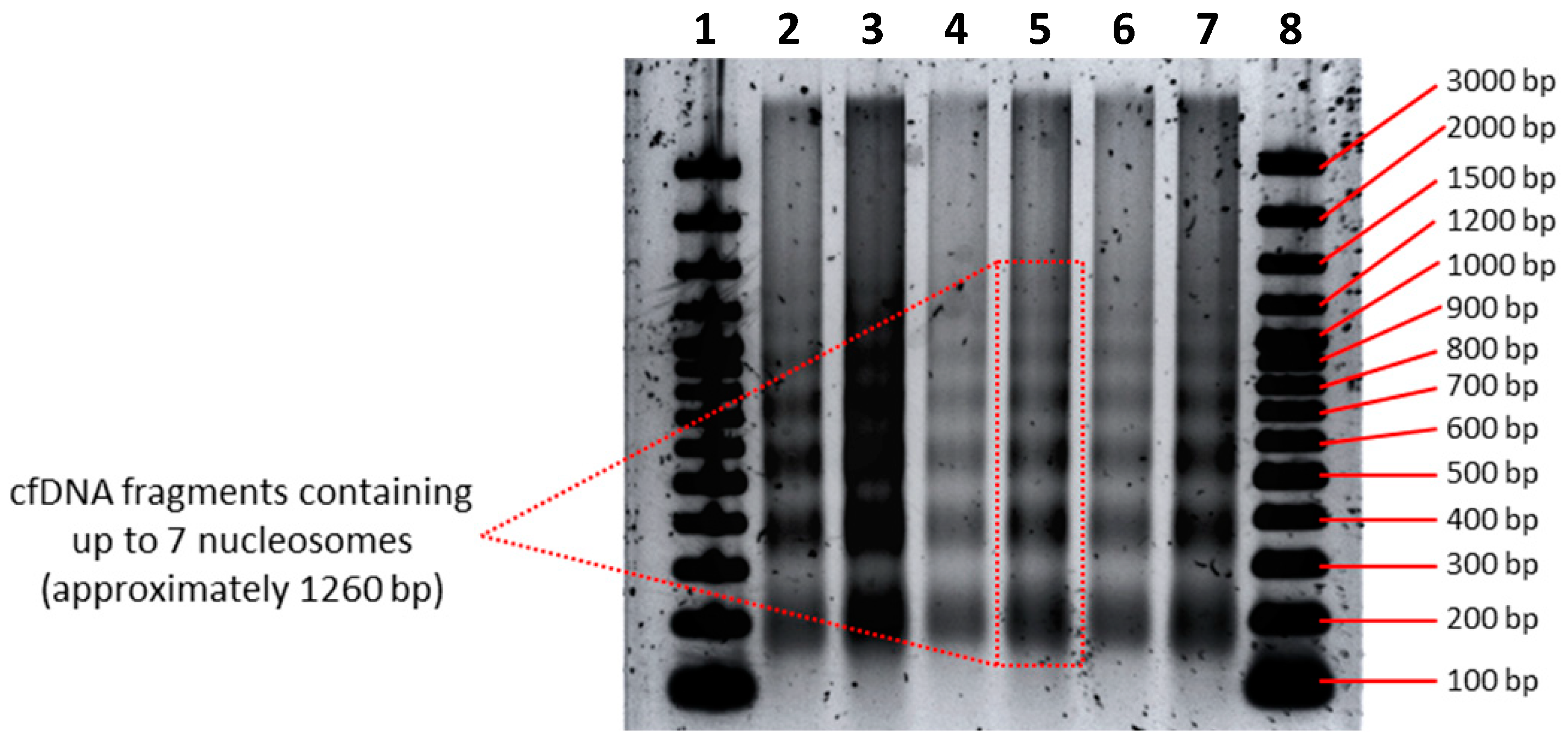 Diagnostics Free Full Text Cell Free Dna Fragmentation Patterns In