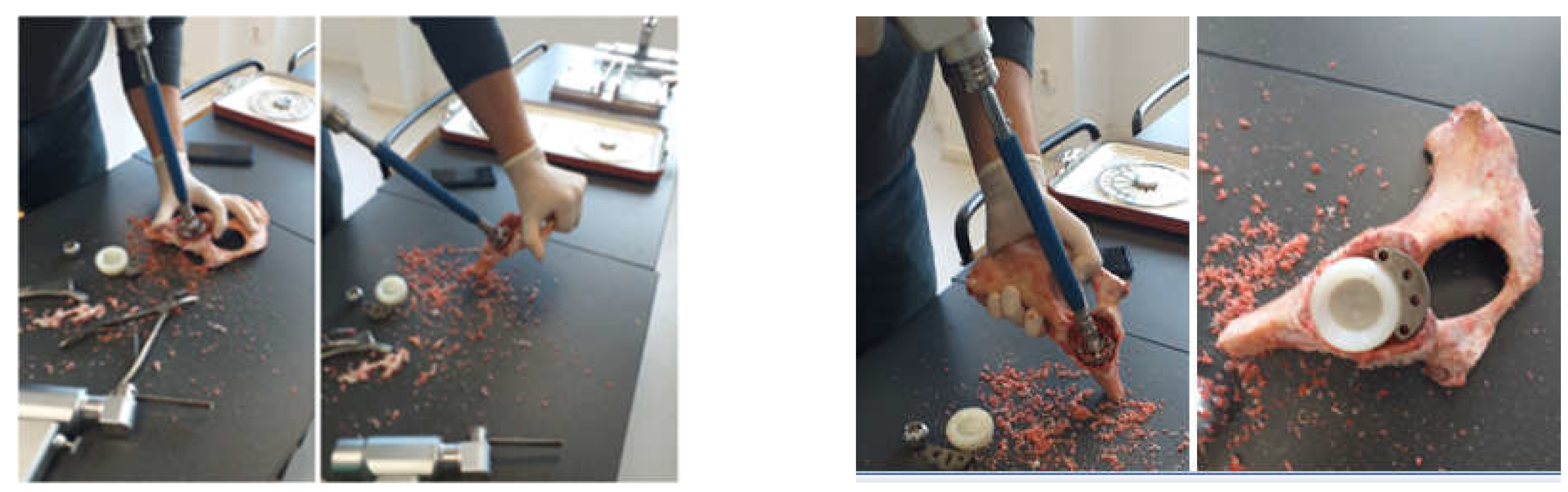 Diagnostics 12 01952 g004