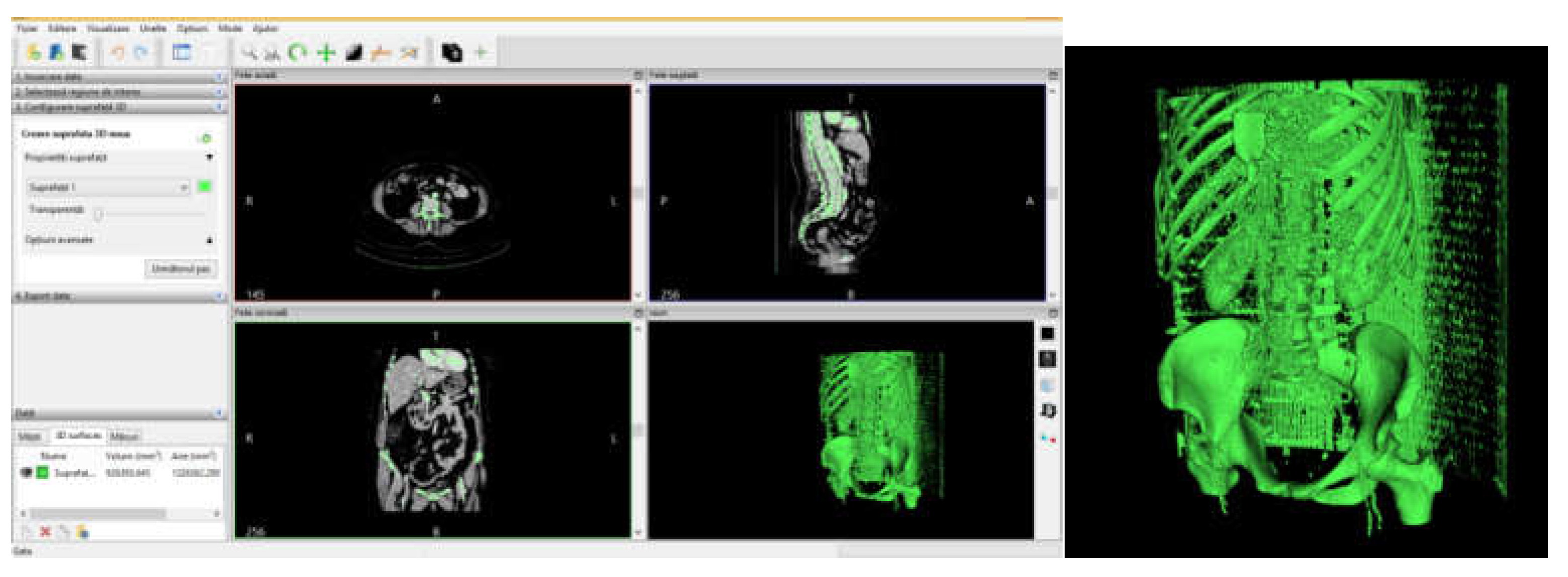 Diagnostics 12 01952 g021