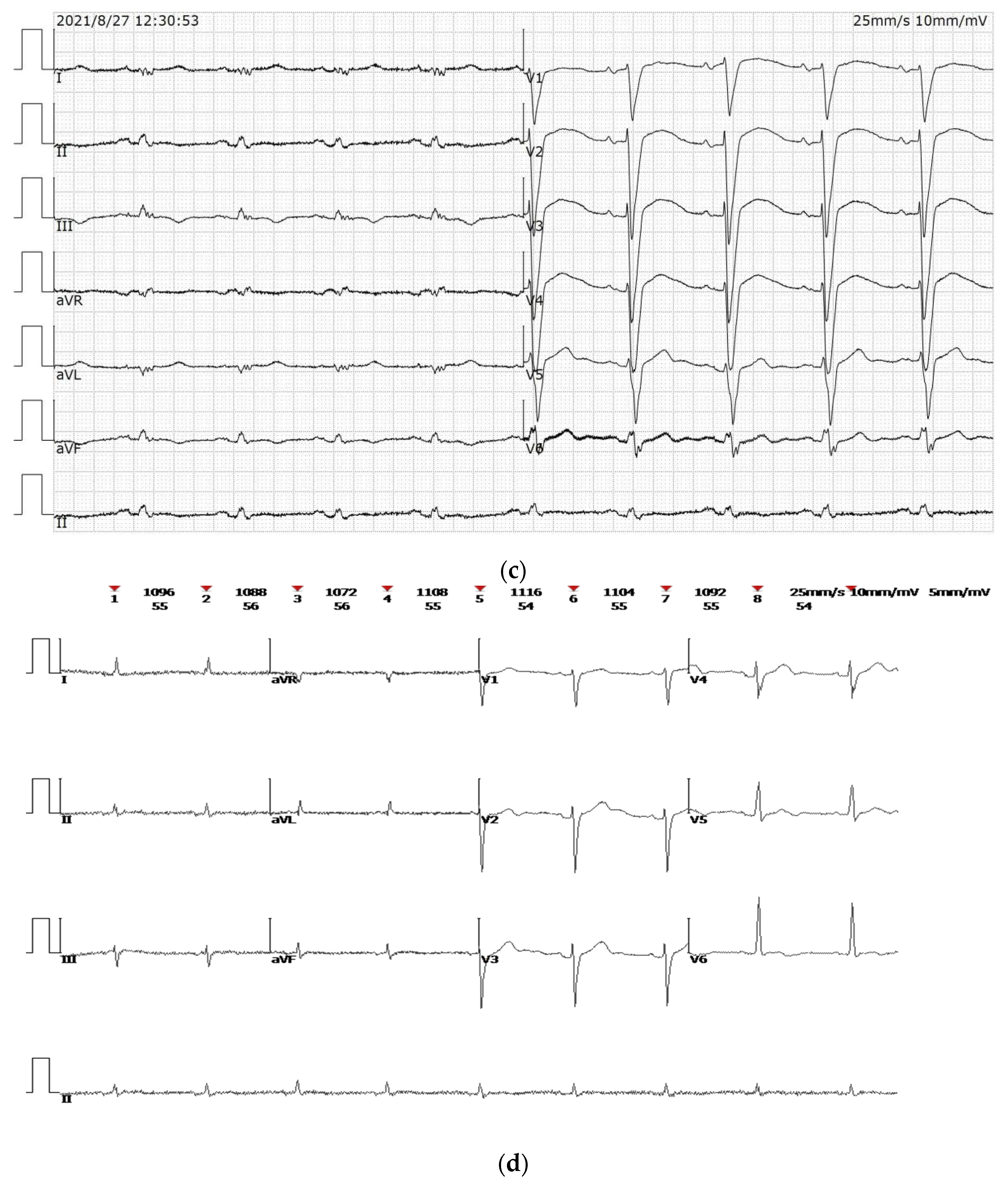 Diagnostics 12 01955 g001b