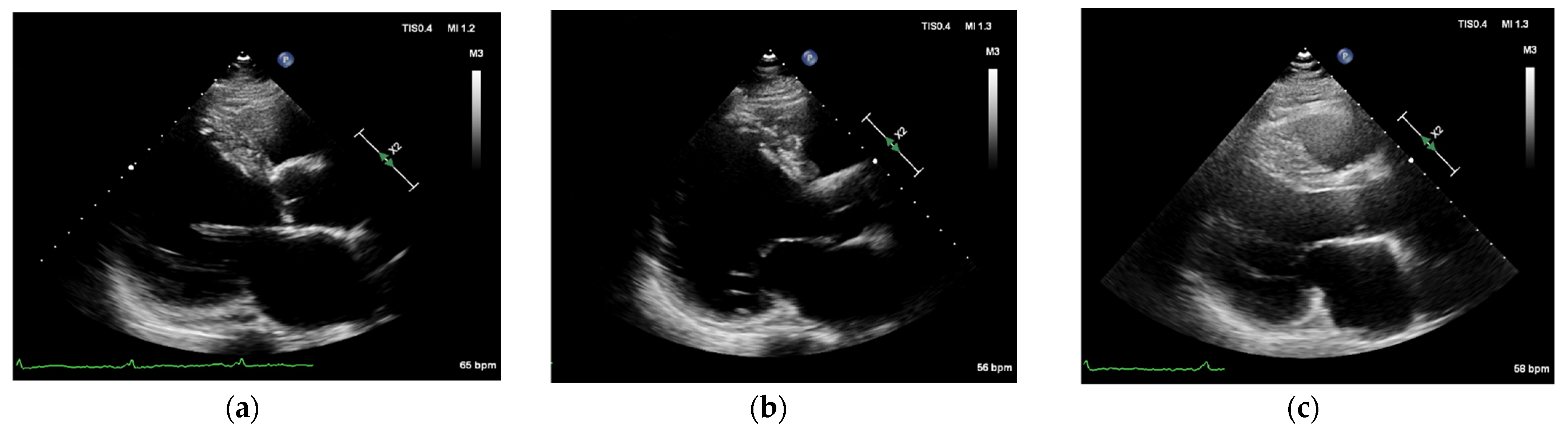 Diagnostics 12 01955 g002