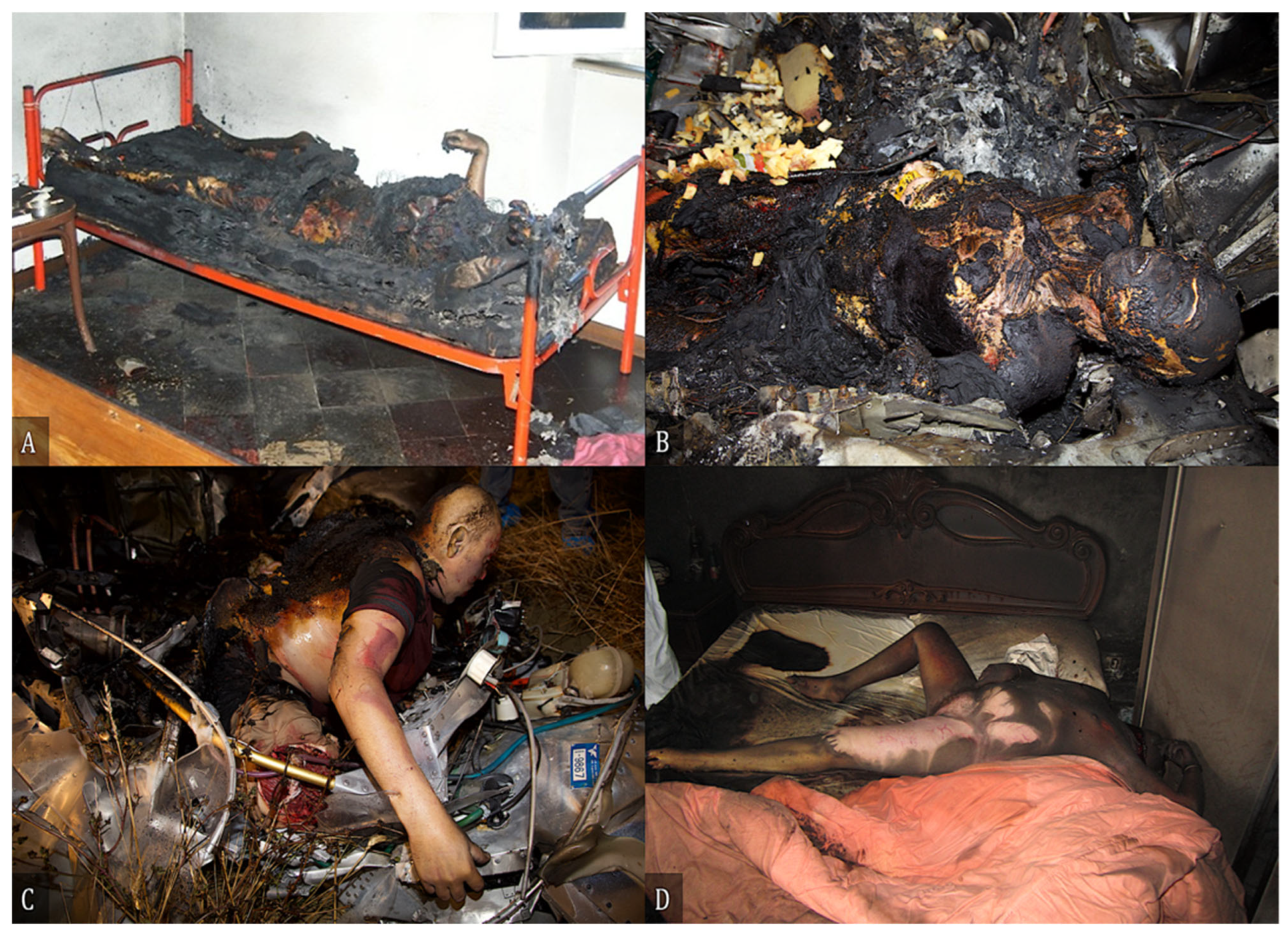 Diagnostics 12 01986 g005 Diagnostics 12 01986 g005