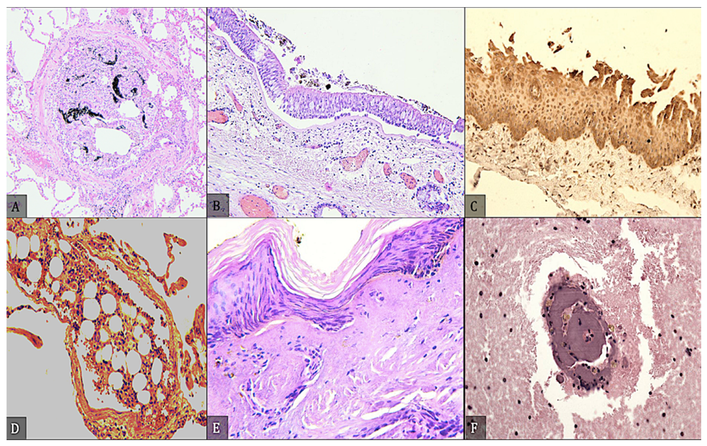 Diagnostics 12 01986 g009 Diagnostics 12 01986 g009
