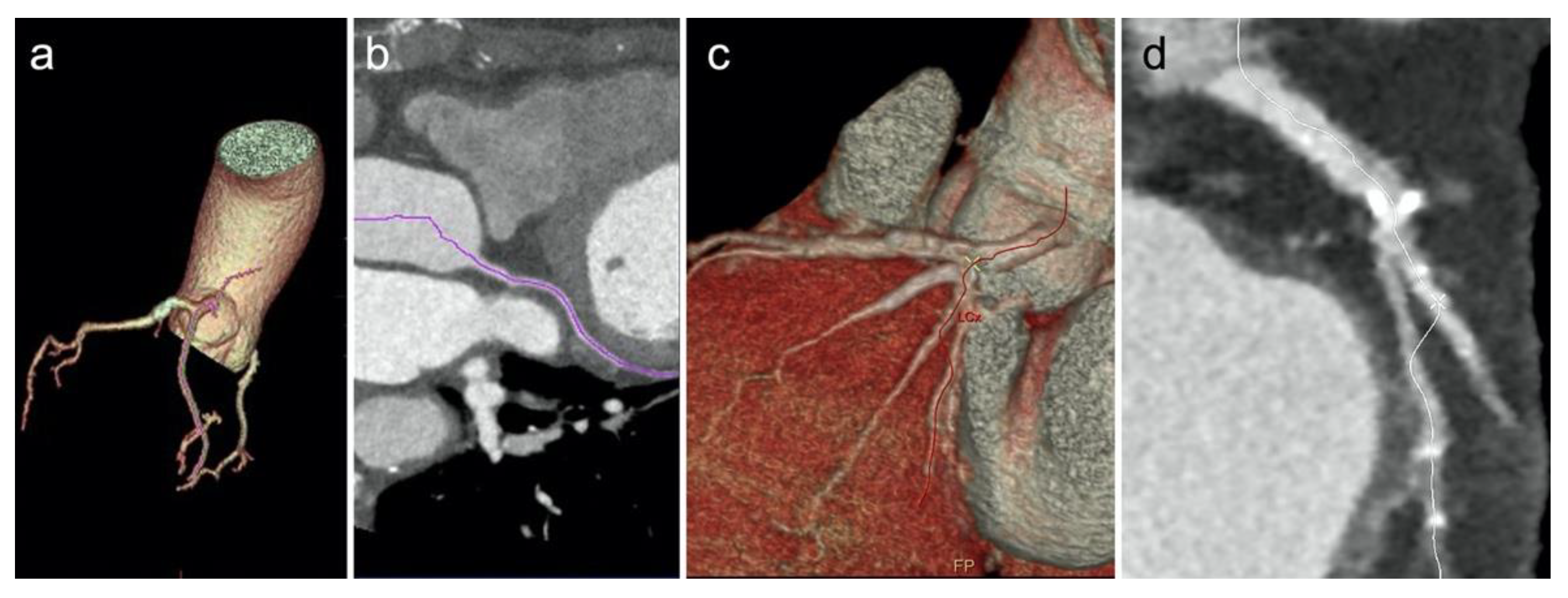 Diagnostics 12 01987 g004 Diagnostics 12 01987 g004