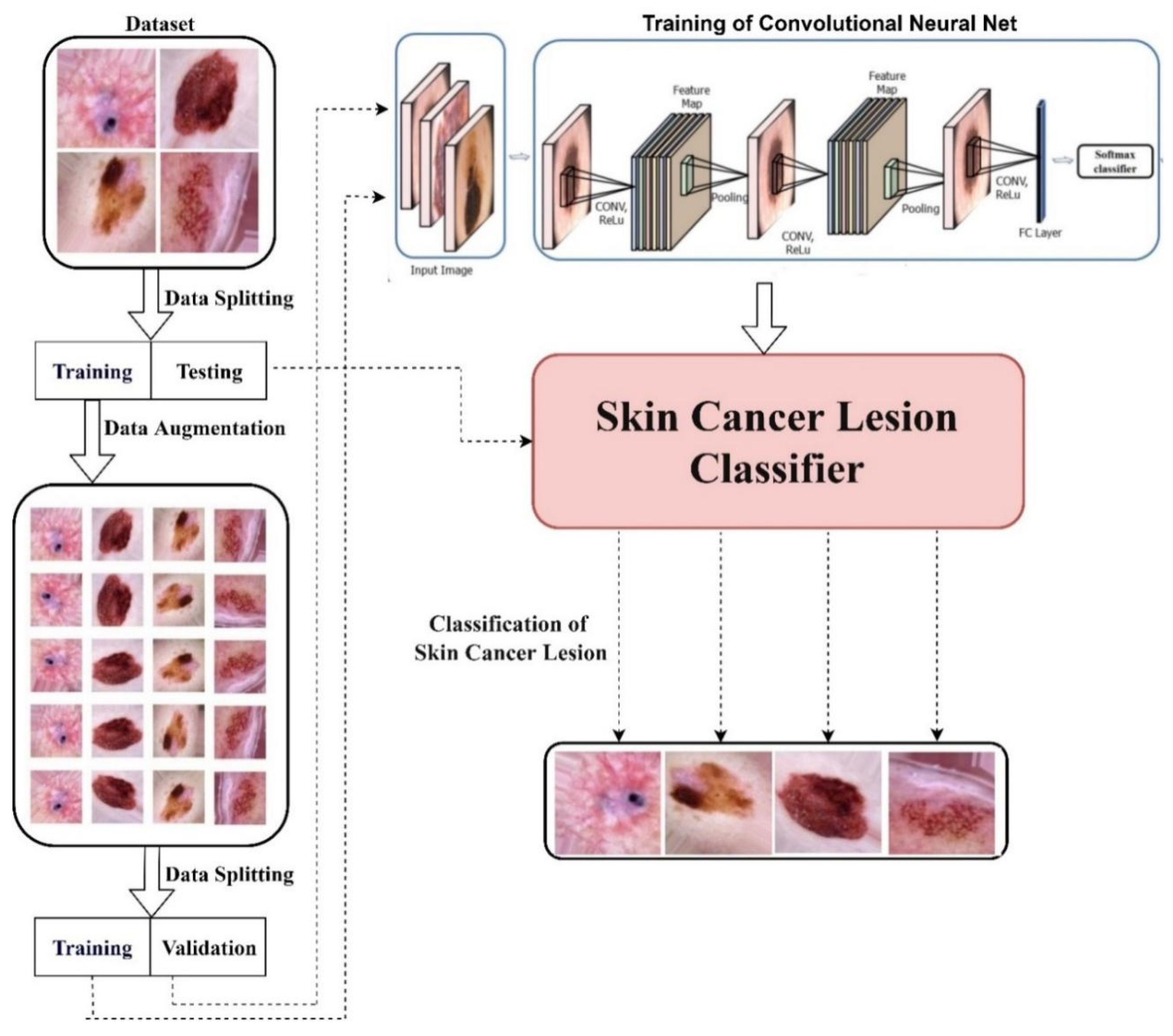 Skin Cancer Detection  Vision and Image Processing Lab