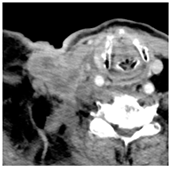 Diagnostics 12 02156 i003