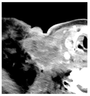 Diagnostics 12 02156 i005