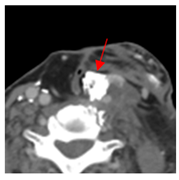 Diagnostics 12 02156 i008