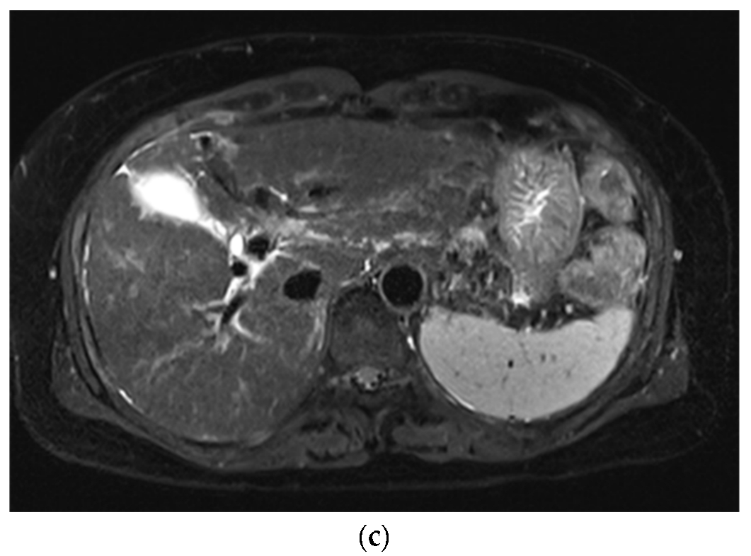 Diagnostics 12 02164 g002b