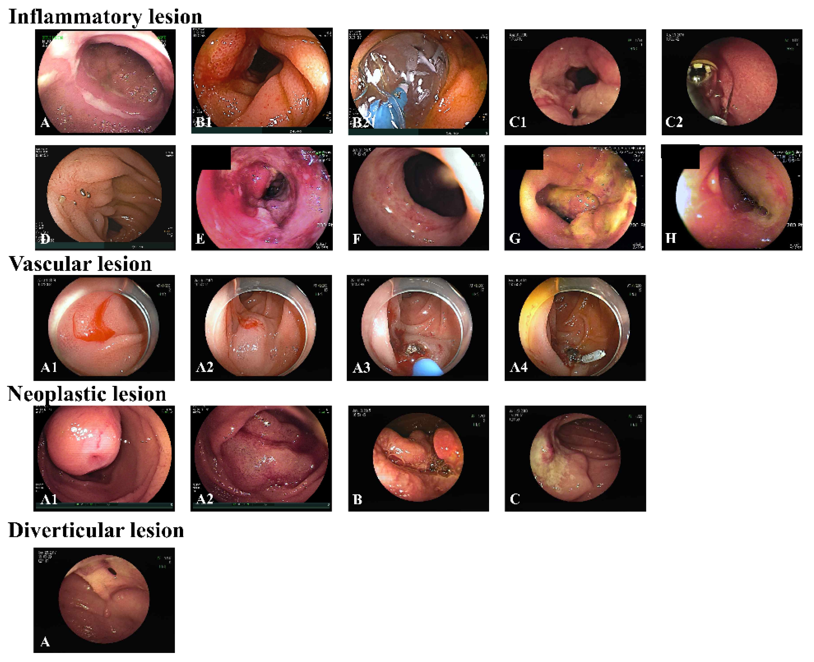 Diagnostics | Free Full-Text | Indication, Location of the Lesion,  Diagnostic Yield, and Therapeutic Yield of Double-Balloon Enteroscopy:  Seventeen Years of Experience