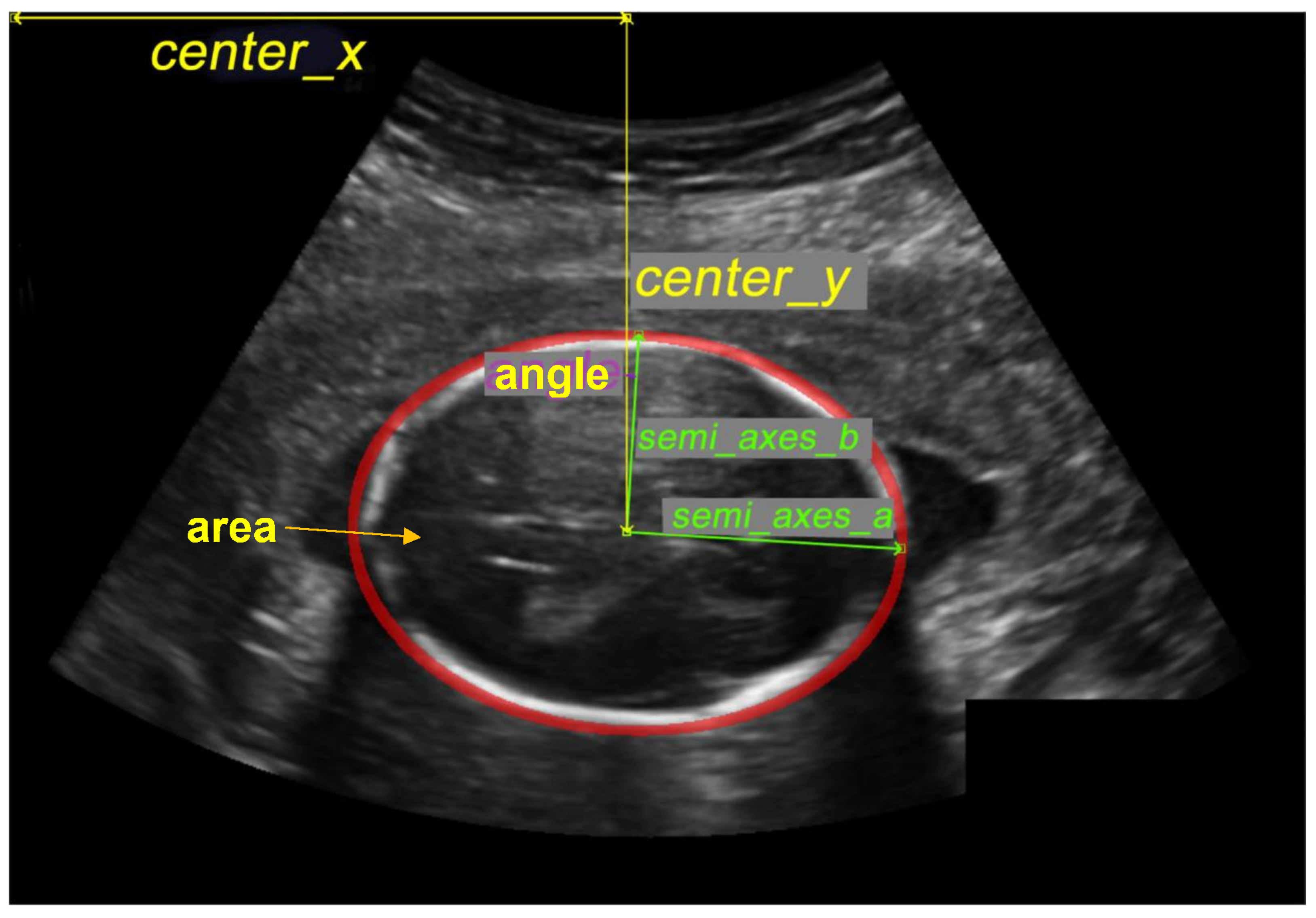 Diagnostics 12 02229 g004