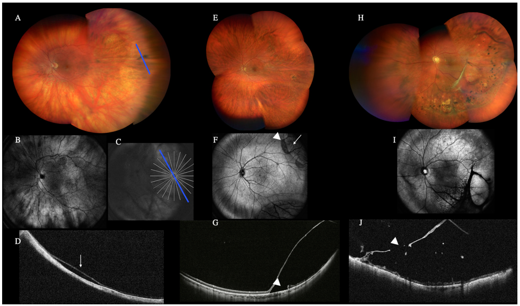 Diagnostics, Free Full-Text