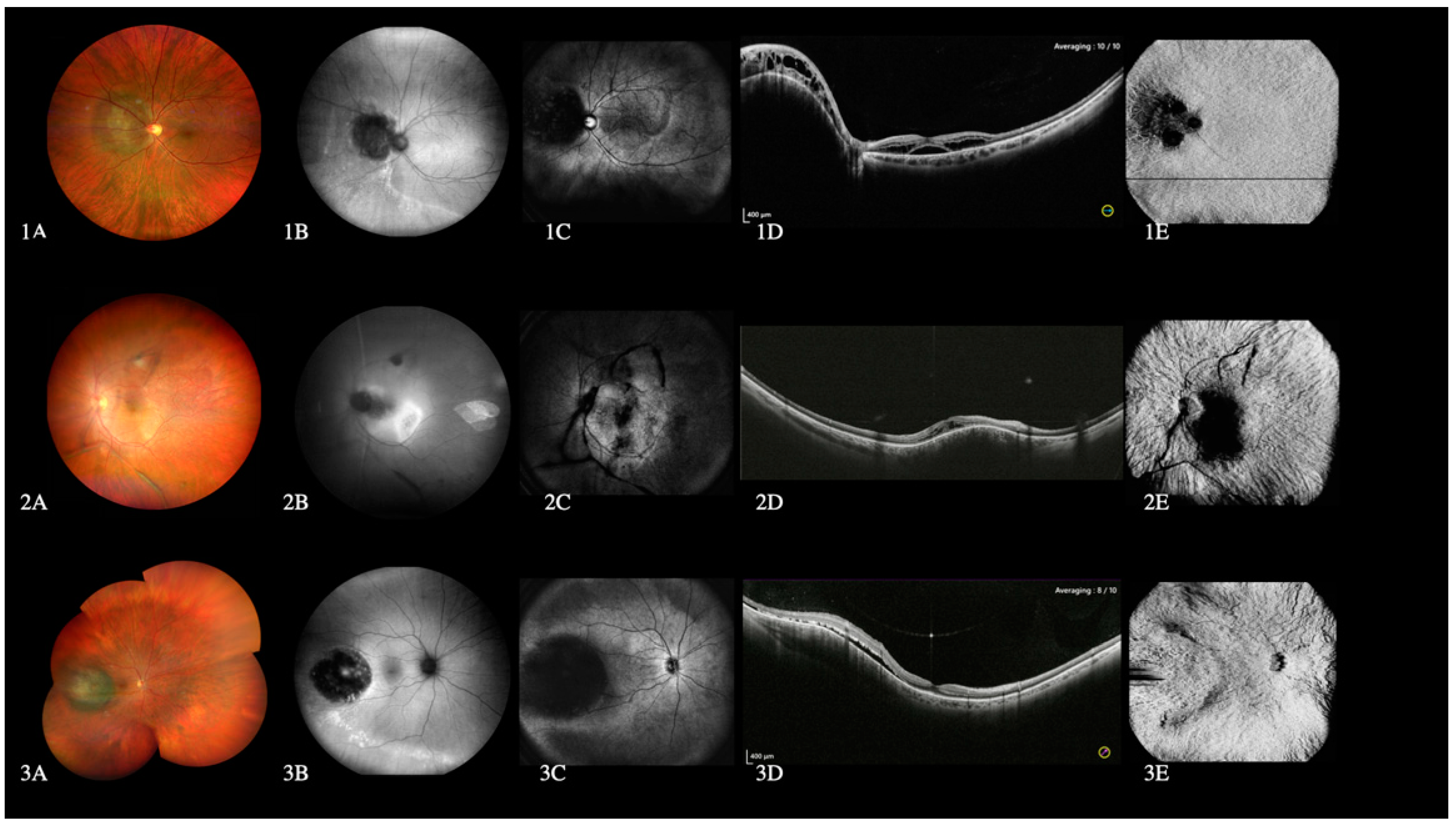 Diagnostics 12 02247 g004 Diagnostics 12 02247 g004