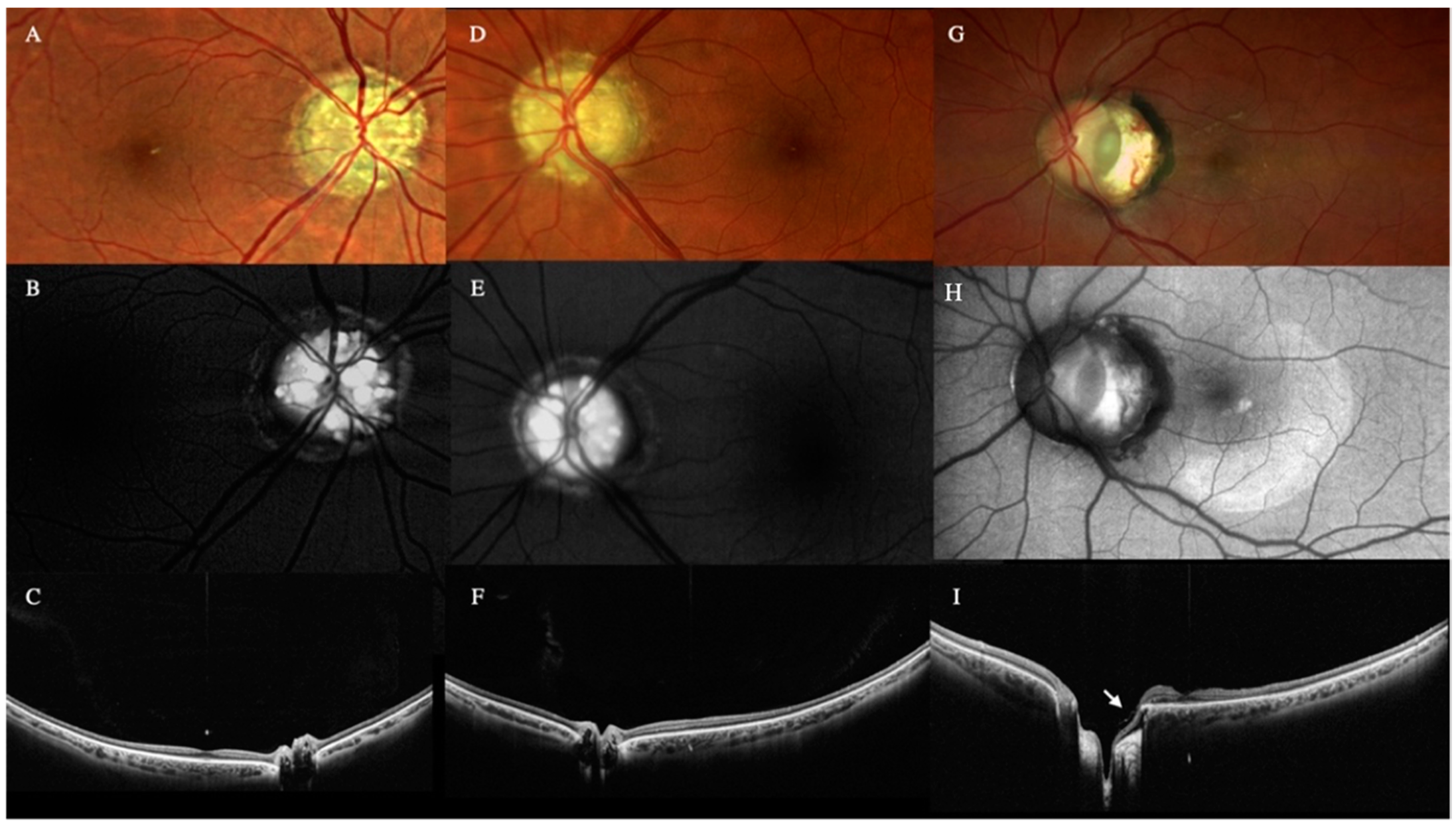 Diagnostics 12 02247 g005 Diagnostics 12 02247 g005