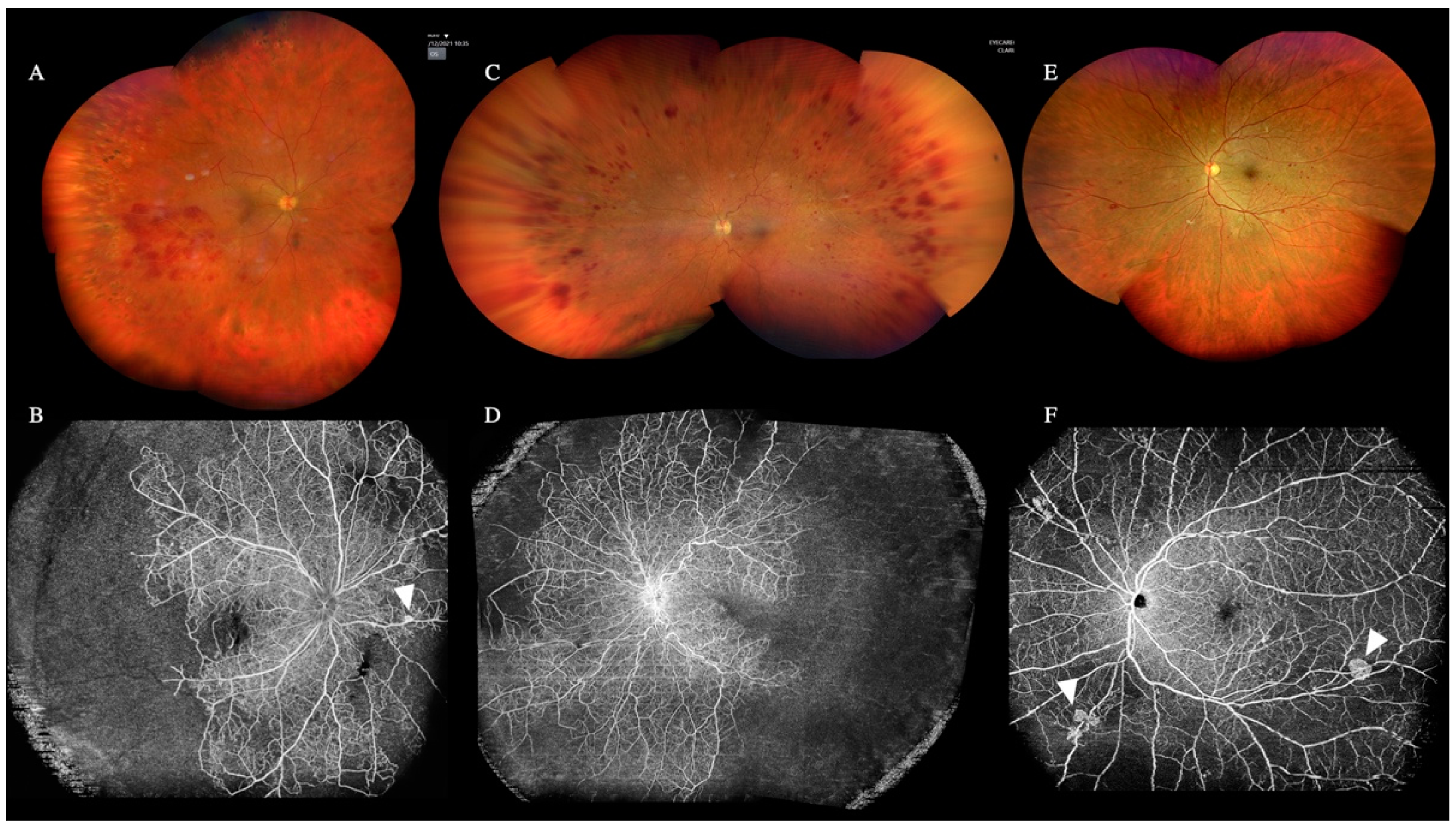 Diagnostics 12 02247 g008 Diagnostics 12 02247 g008