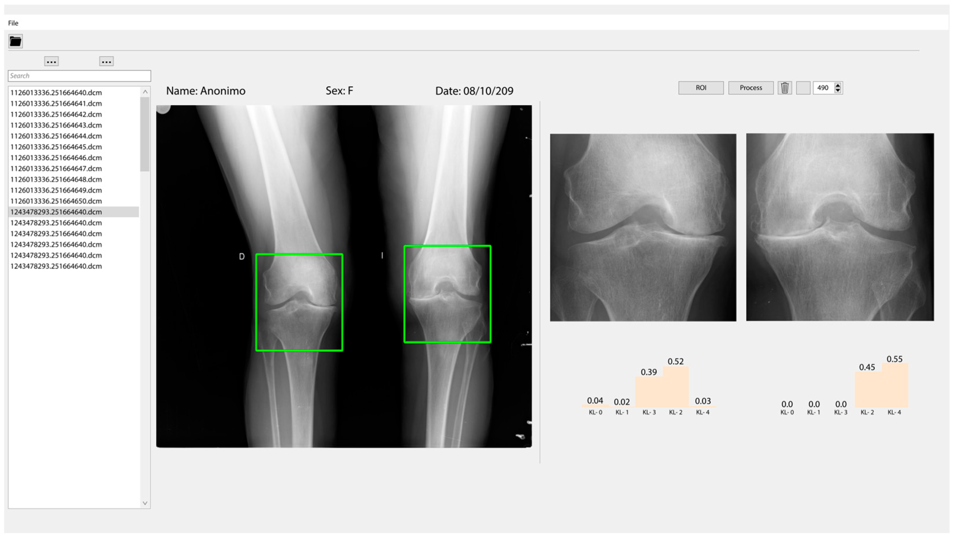 Diagnostics 12 02362 g009 Diagnostics 12 02362 g009