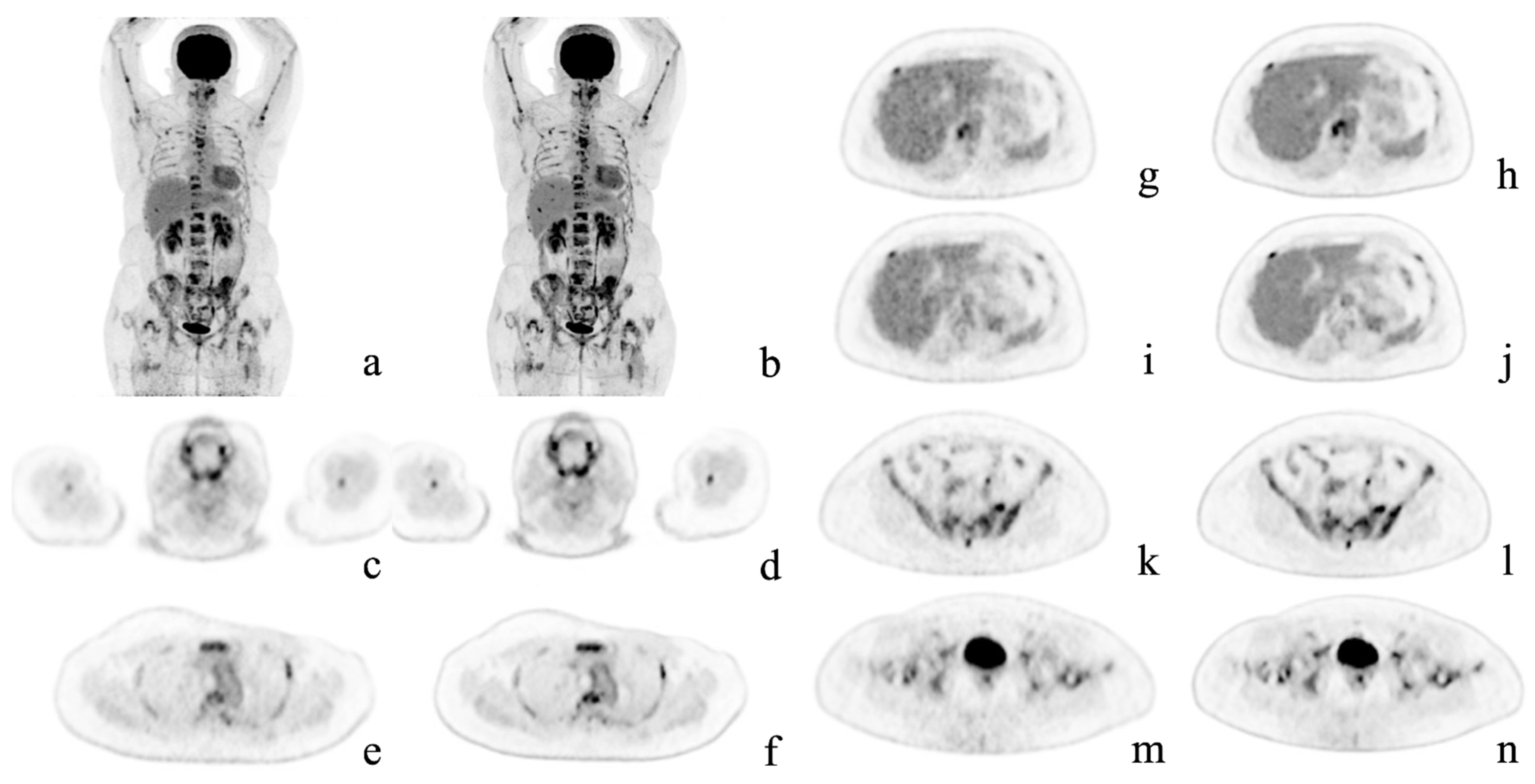 Diagnostics 12 02500 g002 Diagnostics 12 02500 g002