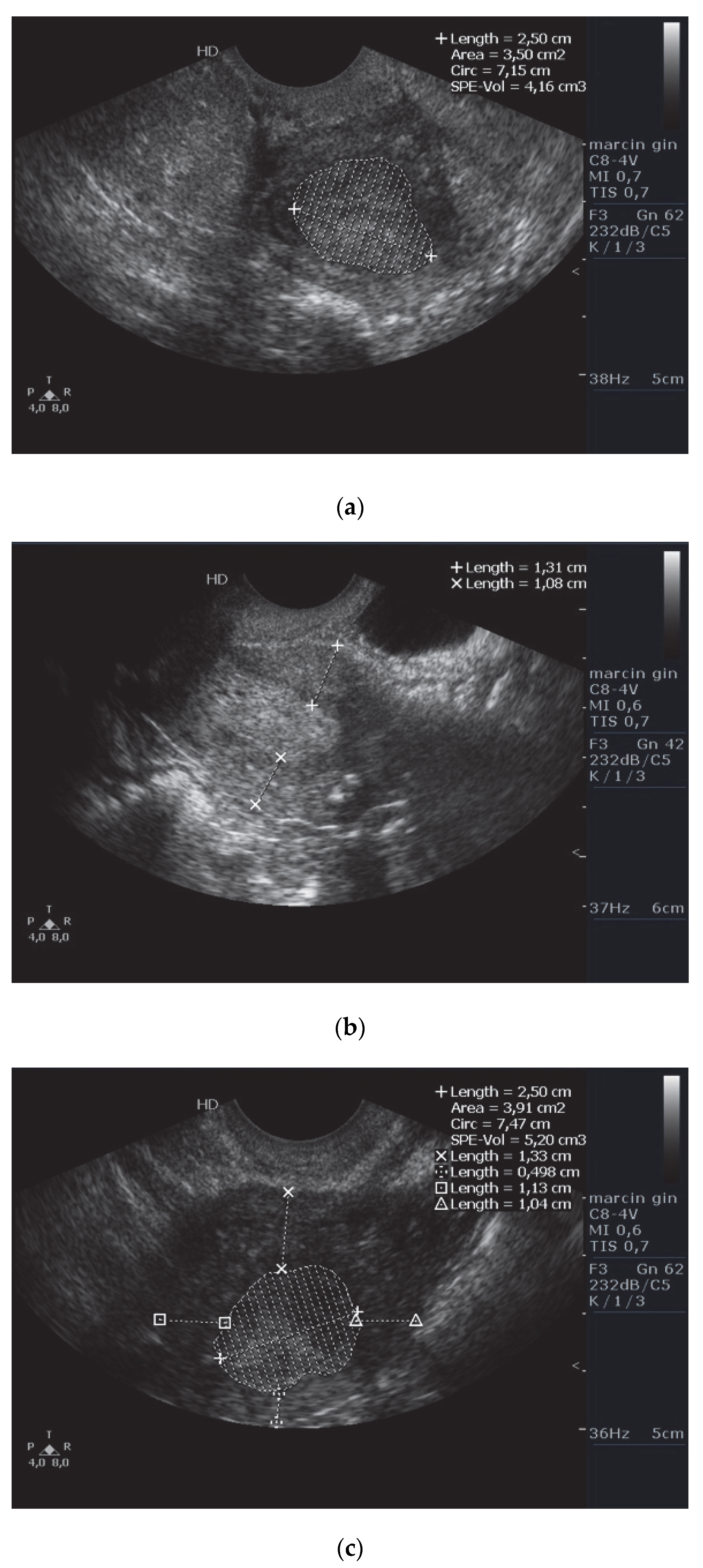 Diagnostics 12 02604 g002a Diagnostics 12 02604 g002a