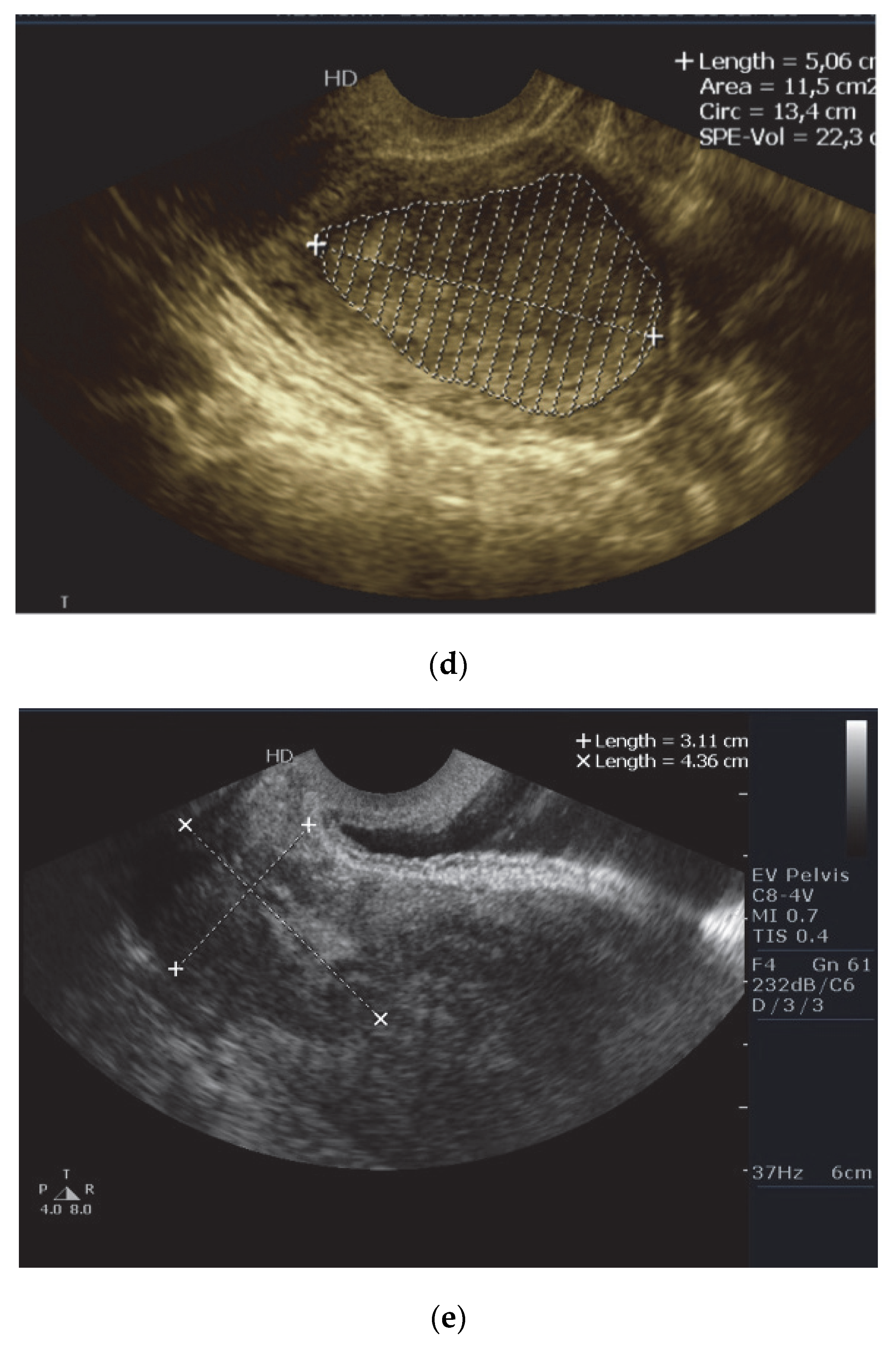 Diagnostics 12 02604 g002b Diagnostics 12 02604 g002b