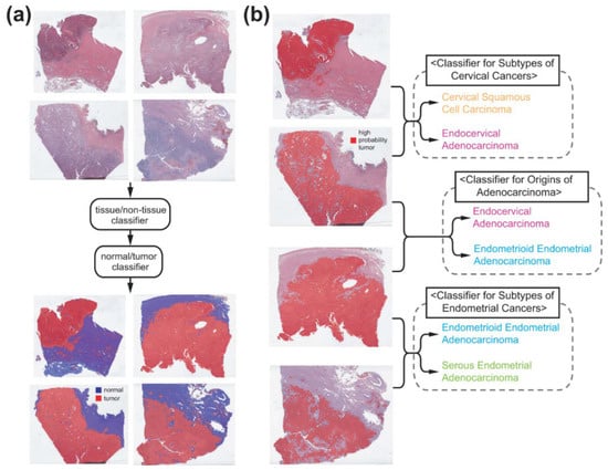 Deep Learning-Based Classification of Uterine Cervical and 