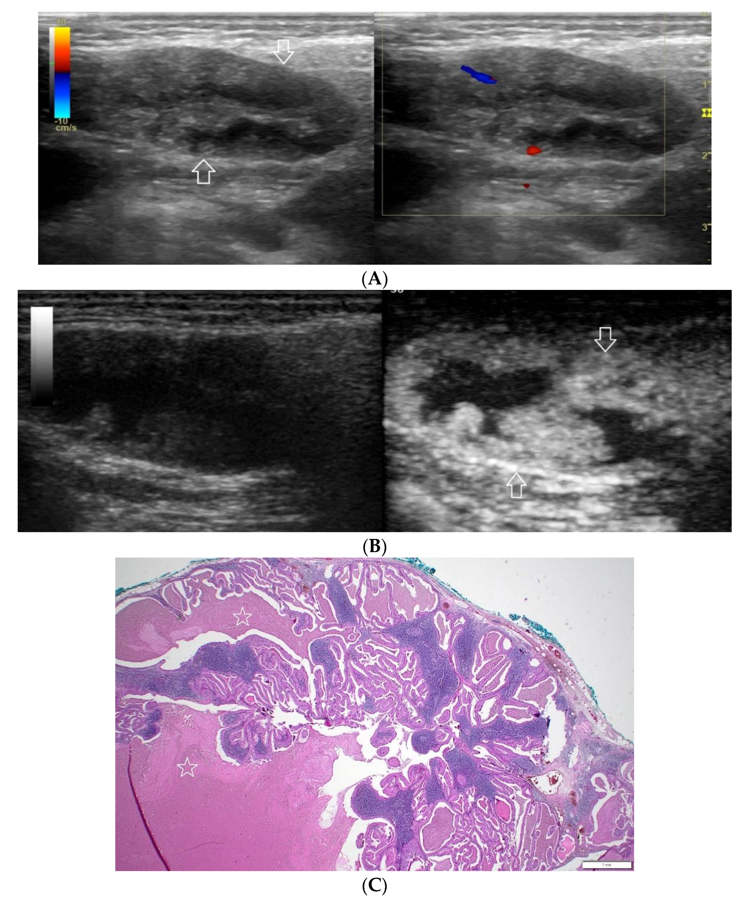 Diagnostics 12 02636 g004 Diagnostics 12 02636 g004