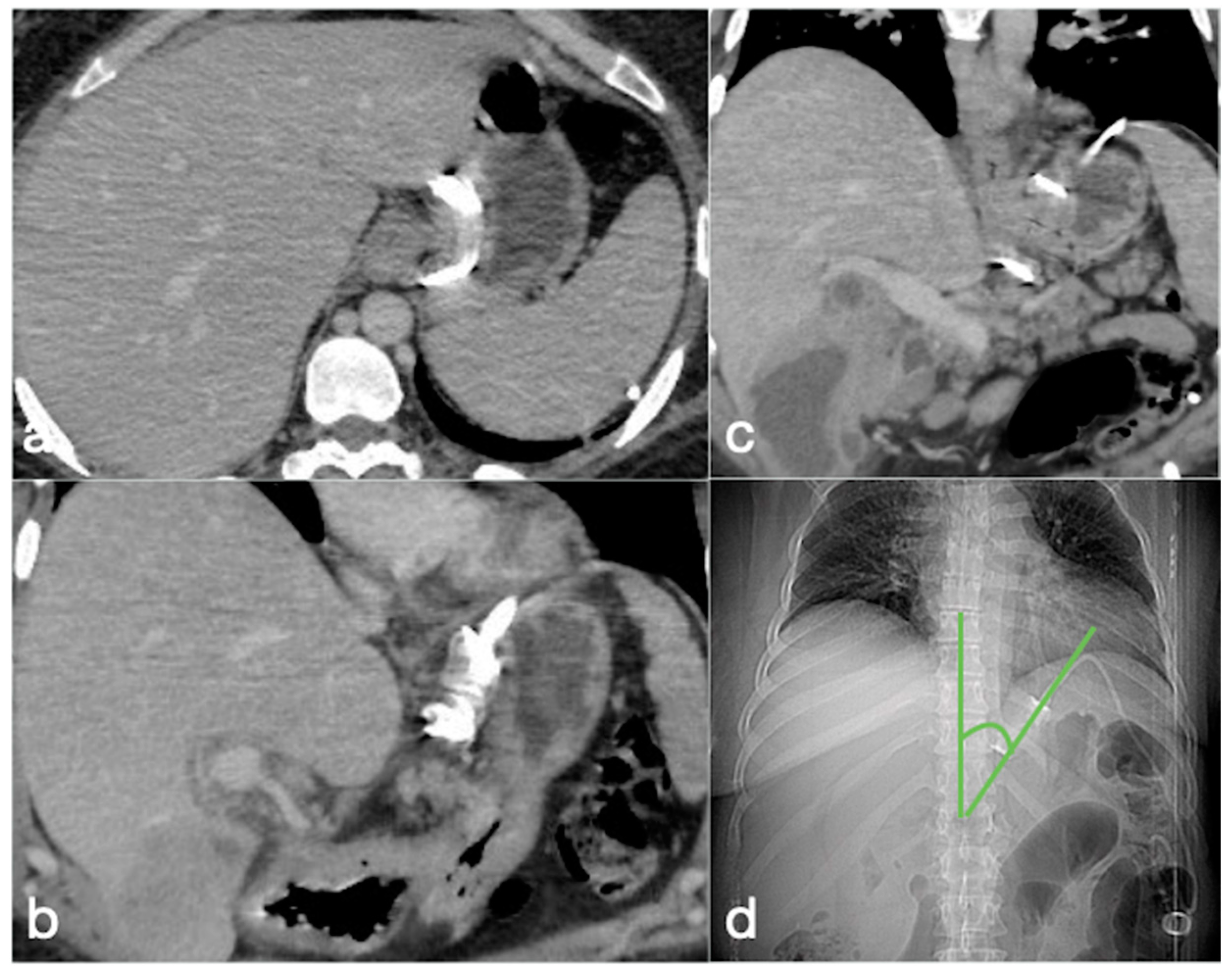 Diagnostics 12 02637 g002 Diagnostics 12 02637 g002