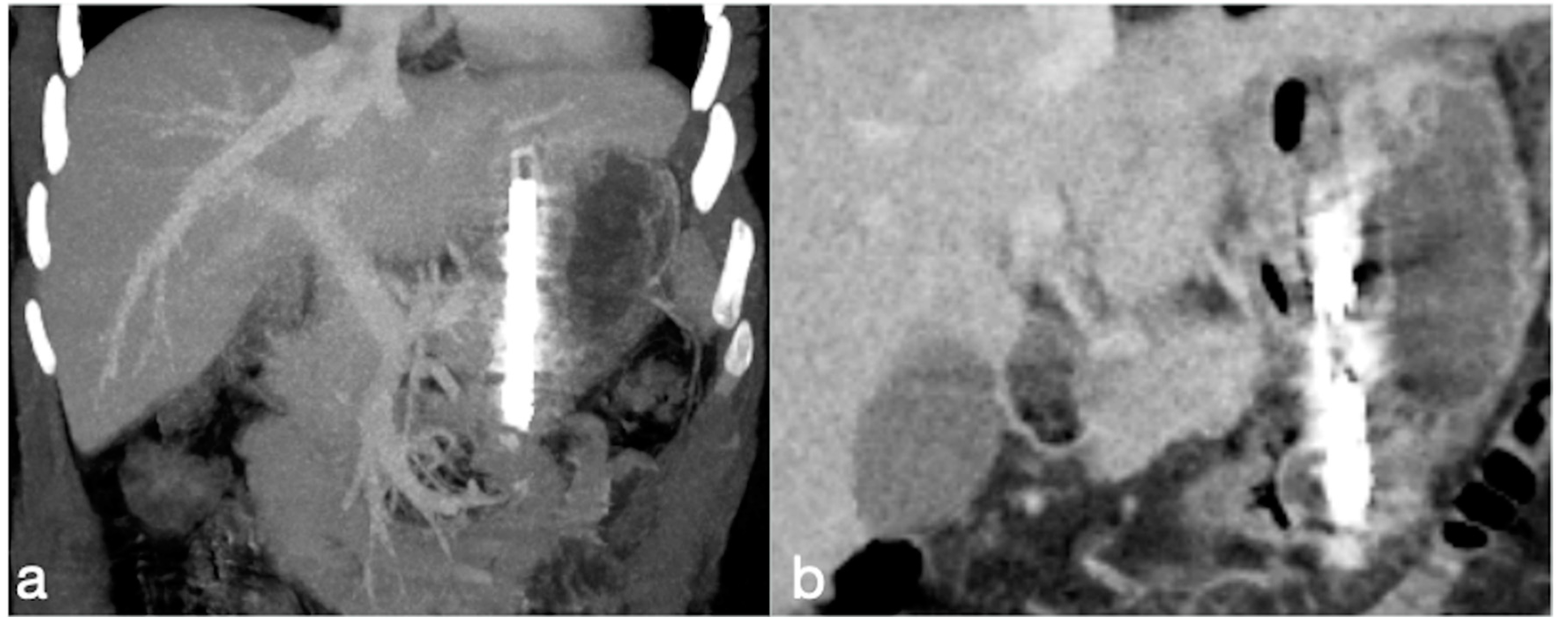 Diagnostics 12 02637 g004 Diagnostics 12 02637 g004