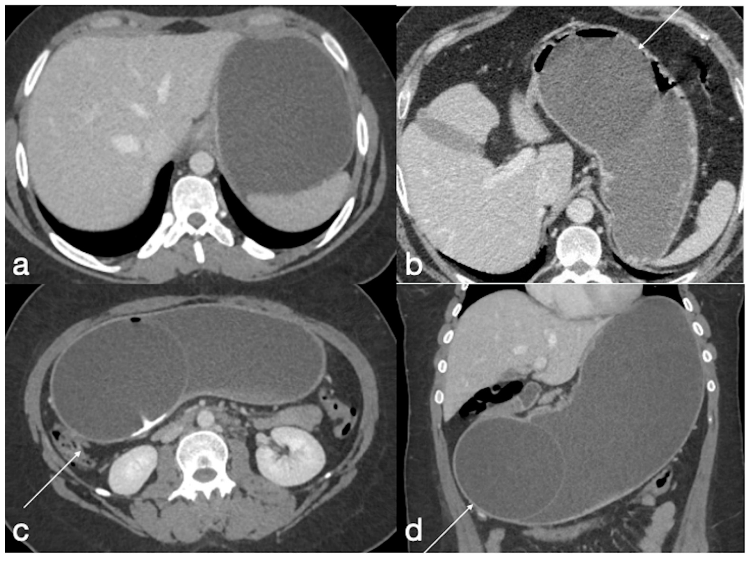 Diagnostics 12 02637 g008 Diagnostics 12 02637 g008