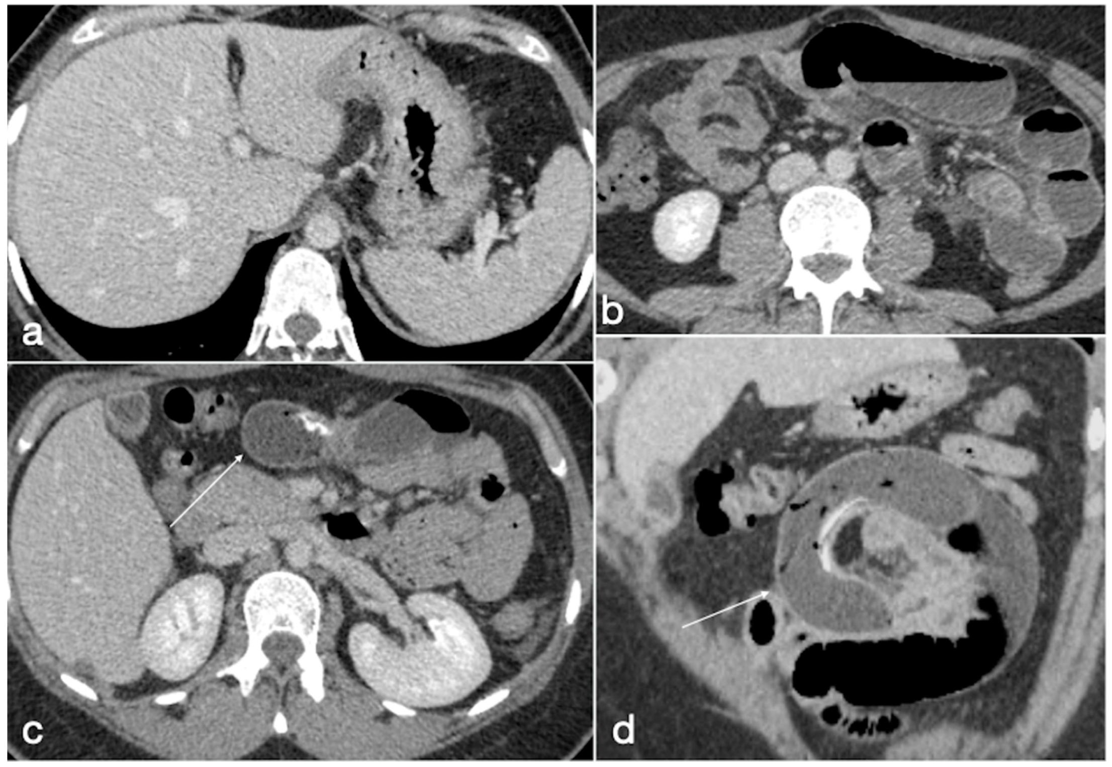 Diagnostics 12 02637 g009 Diagnostics 12 02637 g009