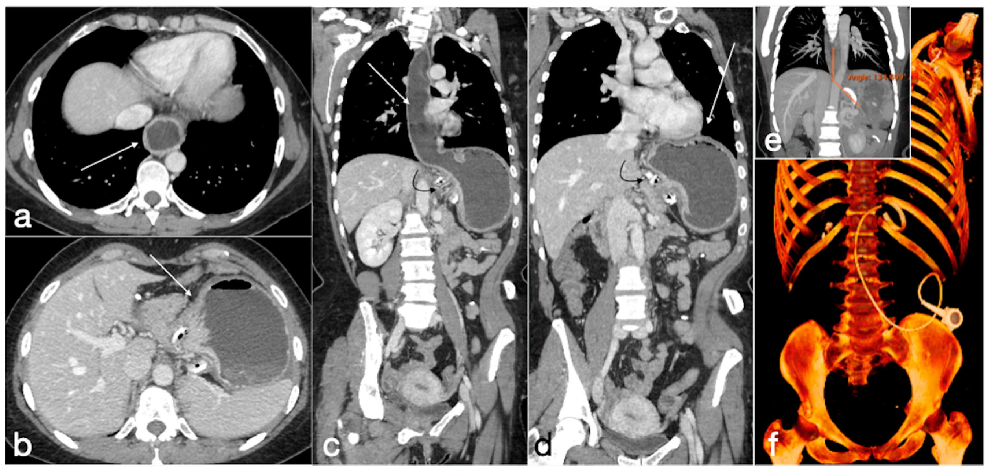 Diagnostics 12 02637 g010 Diagnostics 12 02637 g010