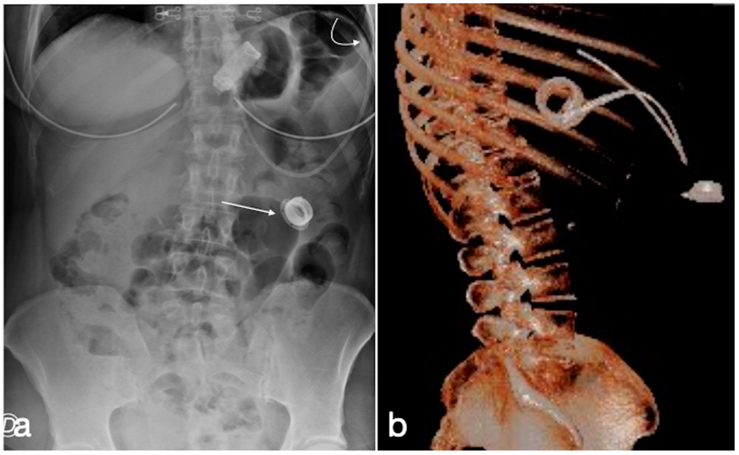 Diagnostics 12 02637 g011 Diagnostics 12 02637 g011
