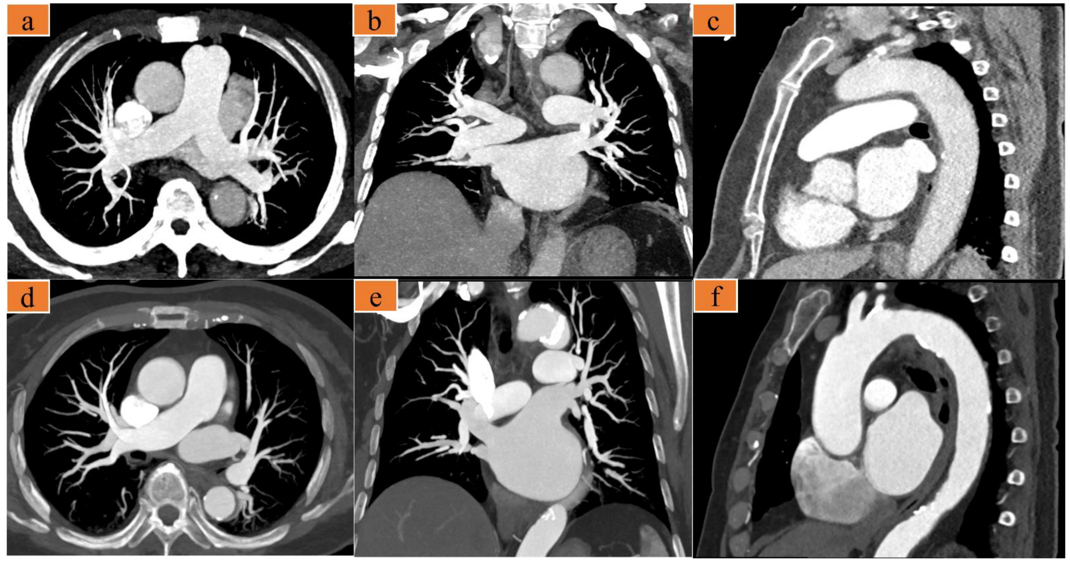 Diagnostics 12 02647 g003 Diagnostics 12 02647 g003