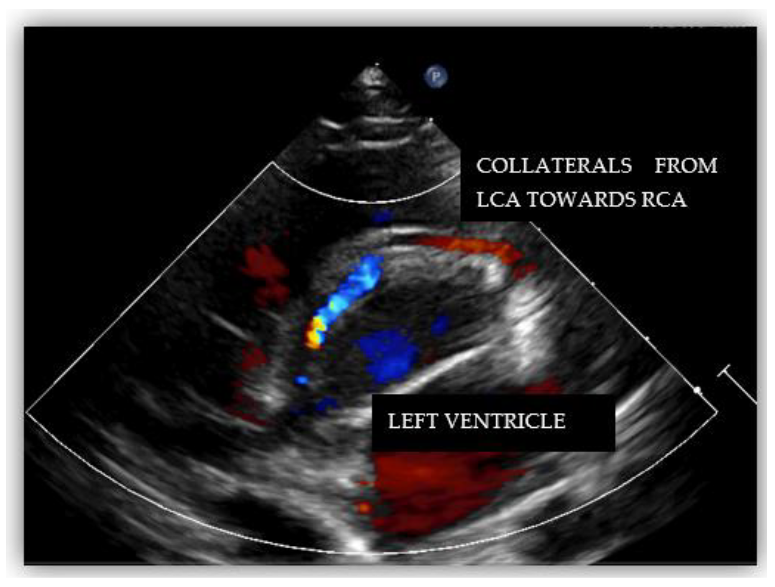 Diagnostics Free Full Text Challenging Diagnosis Of Anomalous